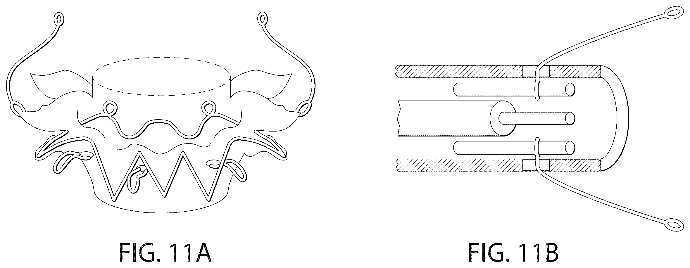 Patent US12611306 Figure 14 – Delivery systems and methods for prosthetic heart valve