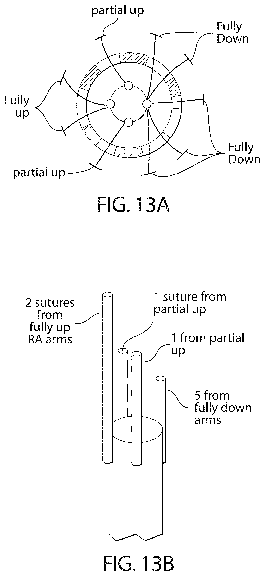 Patent US12611306 Figure 16 – Delivery systems and methods for prosthetic heart valve