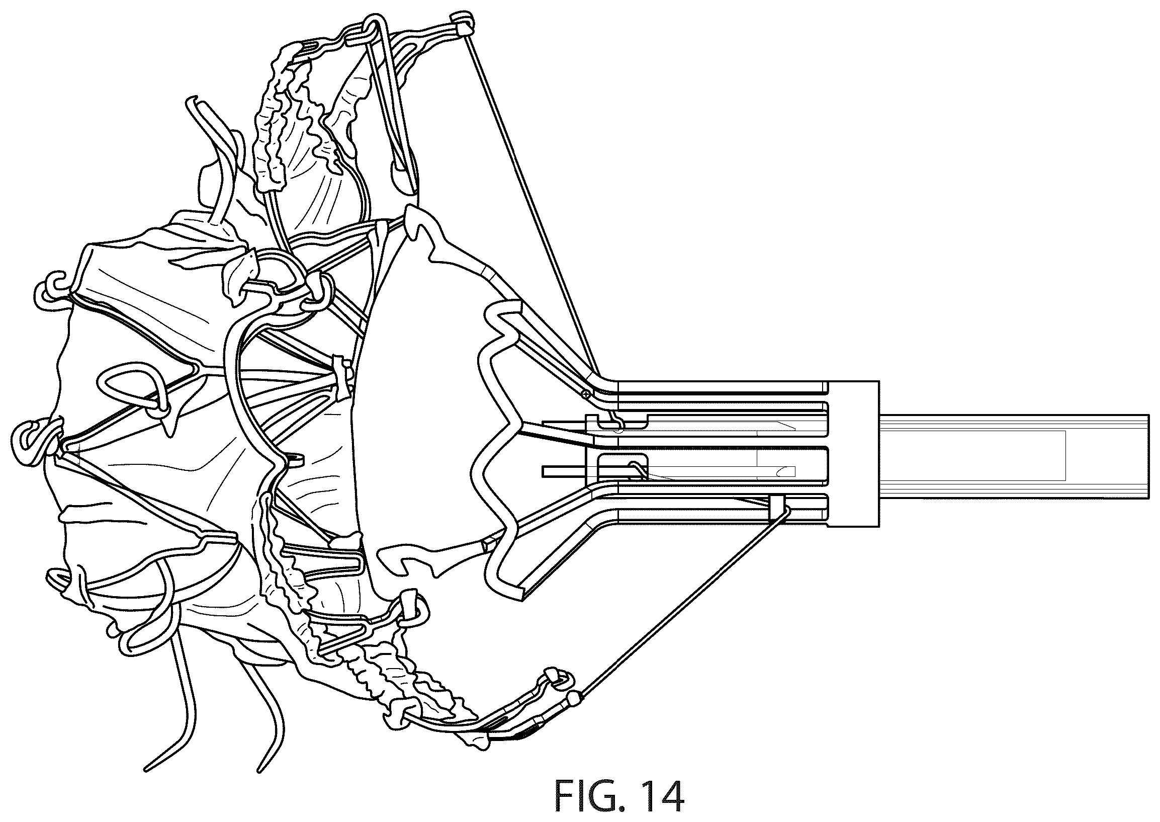 Patent US12611306 Figure 17 – Delivery systems and methods for prosthetic heart valve