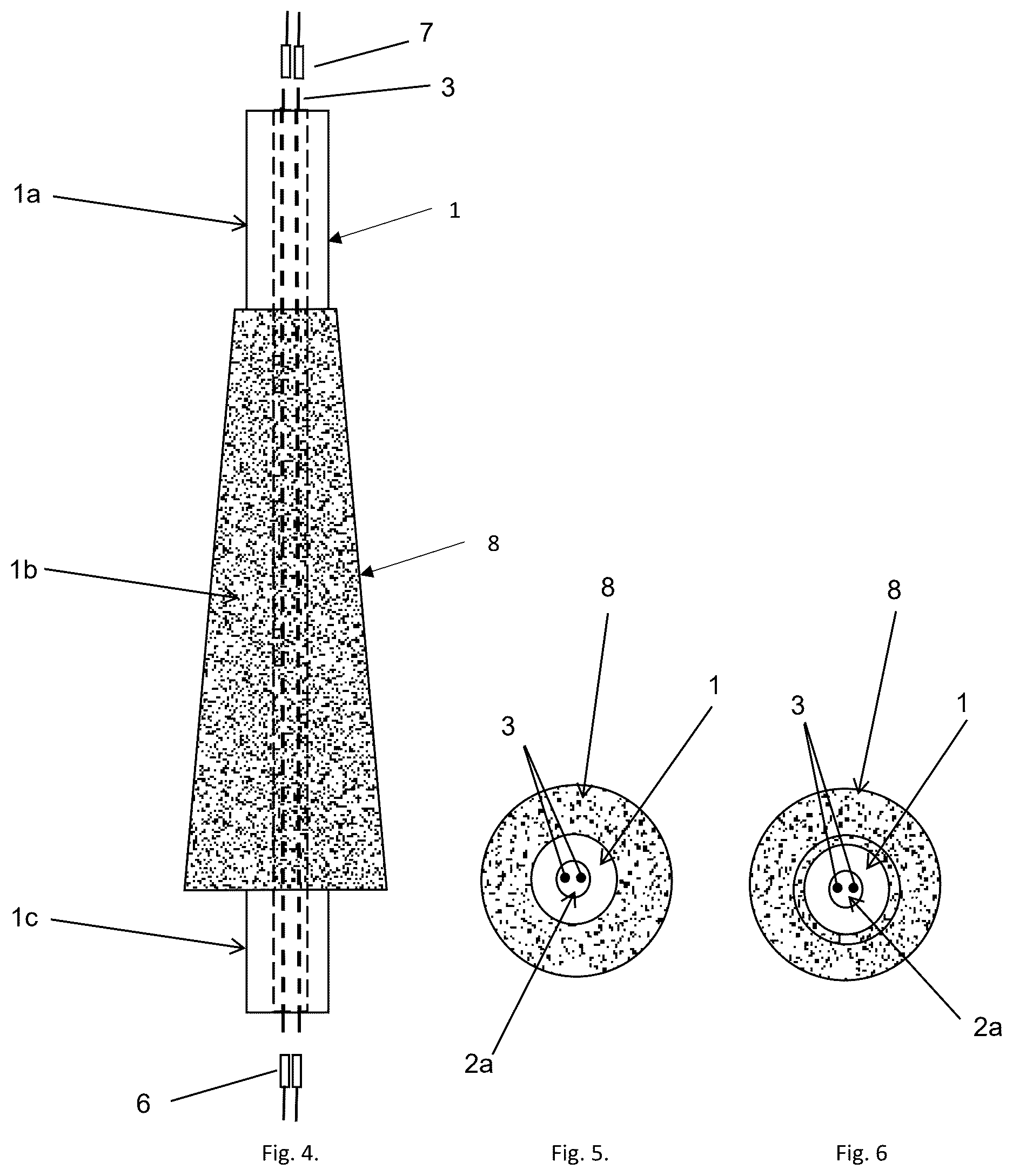 Patent US12611307 Figure 2 – Load-bearing skin and bone integrated pylon with hermetically sealed neural interface