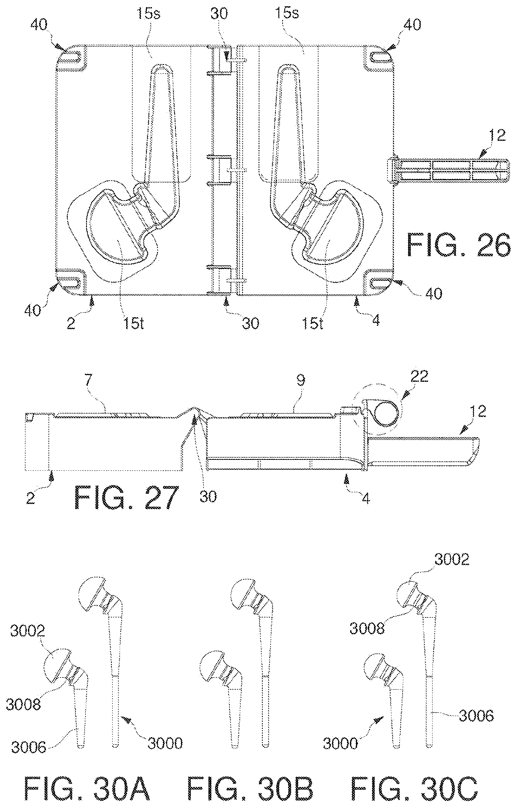 Patent US12611308 Figure 9 – Mold with removable inserts for forming a spacer device for the replacement of a joint prosthesis
