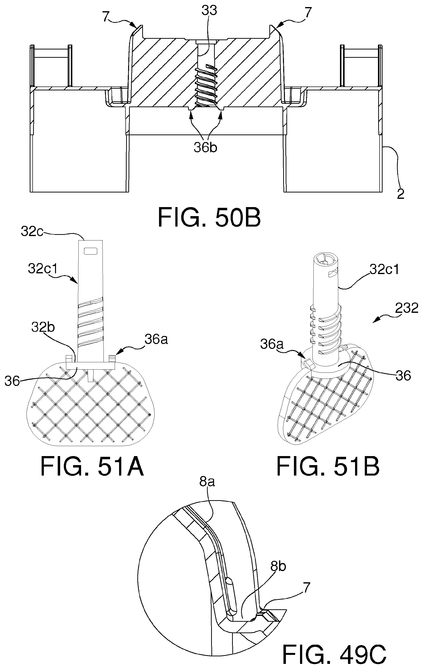 Patent US12611308 Figure 17 – Mold with removable inserts for forming a spacer device for the replacement of a joint prosthesis