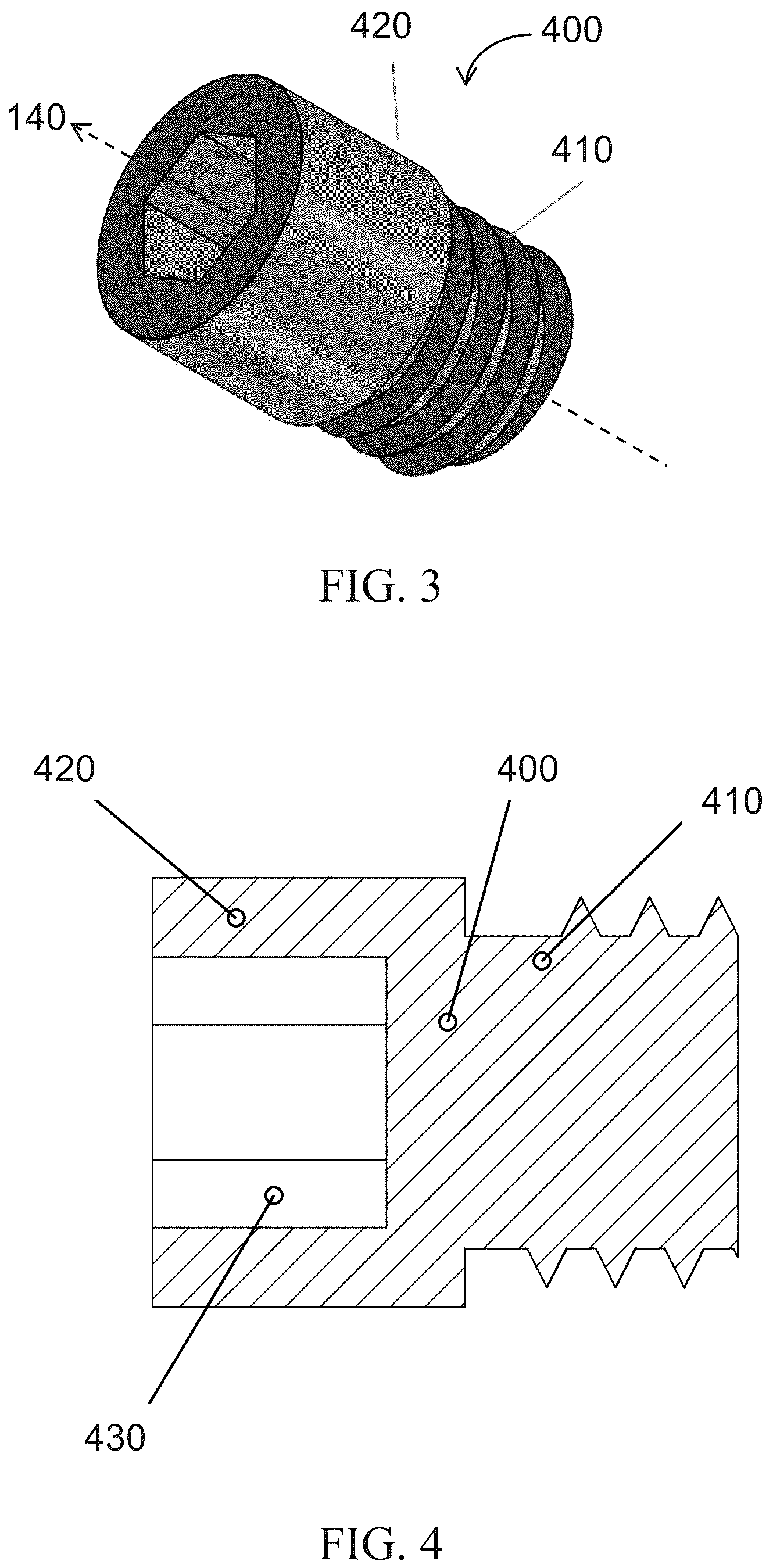 Patent US12611309 Figure 3 – Short implanted prosthesis and method of making same