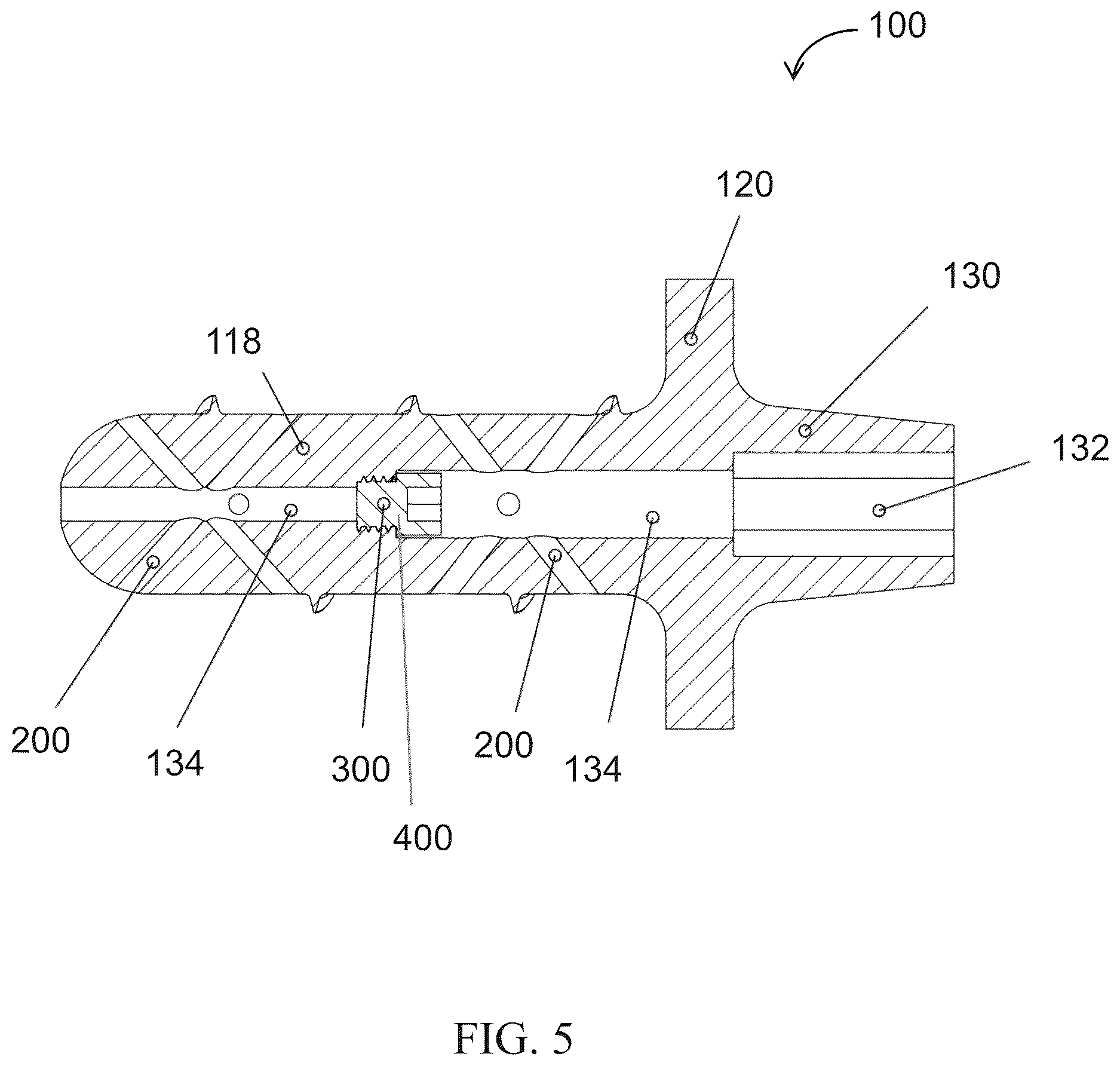 Patent US12611309 Figure 4 – Short implanted prosthesis and method of making same