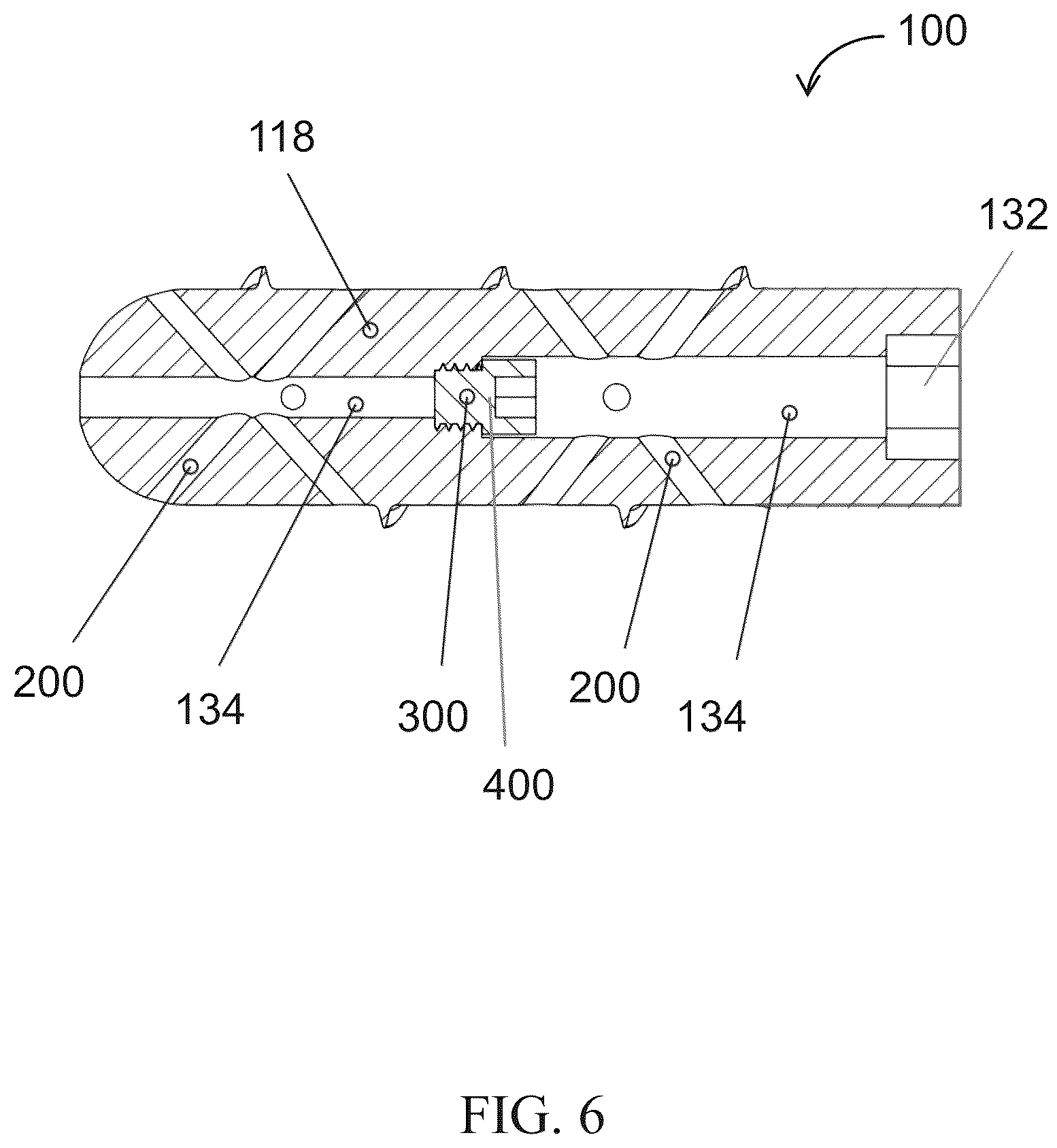 Patent US12611309 Figure 5 – Short implanted prosthesis and method of making same