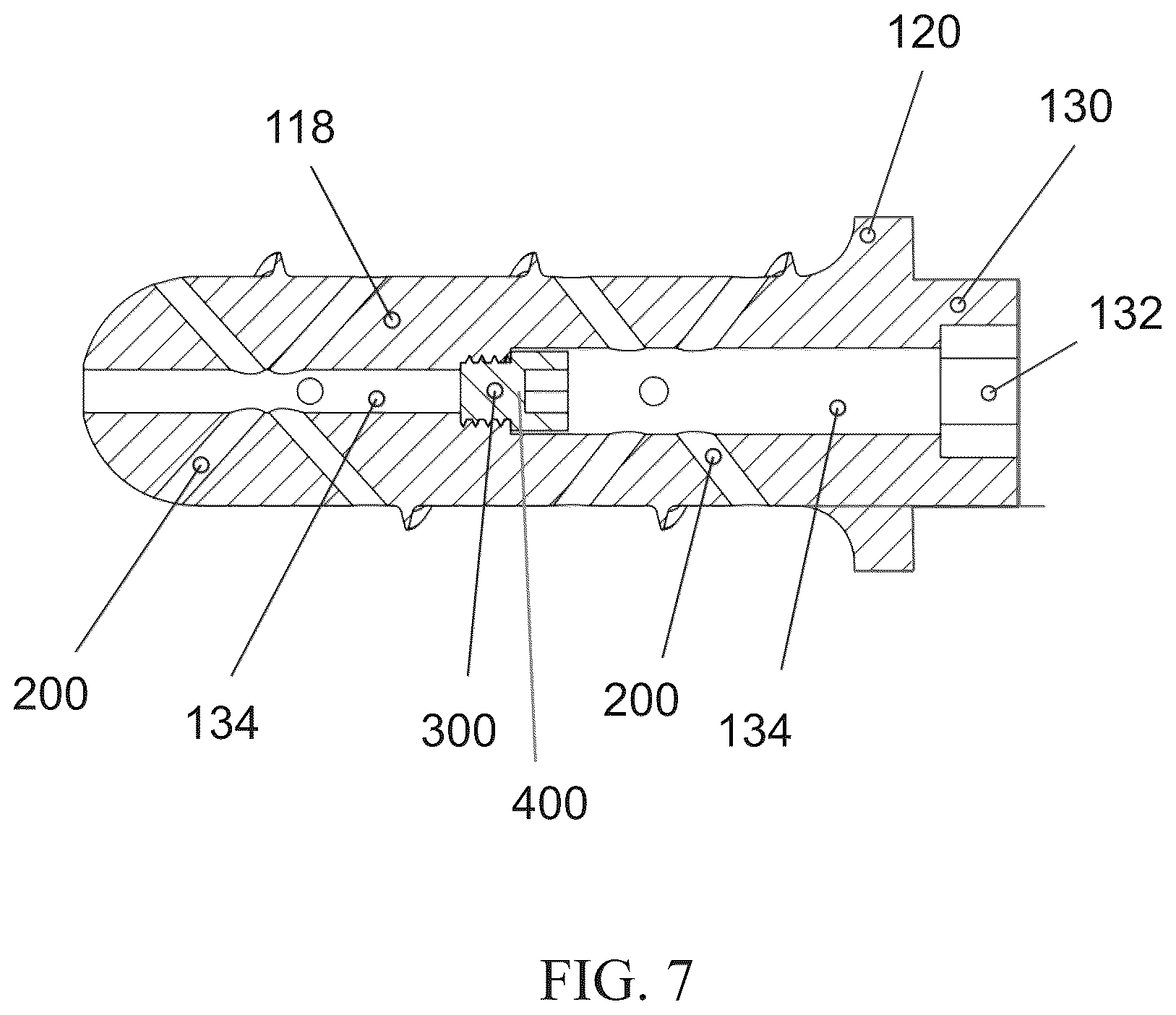 Patent US12611309 Figure 6 – Short implanted prosthesis and method of making same