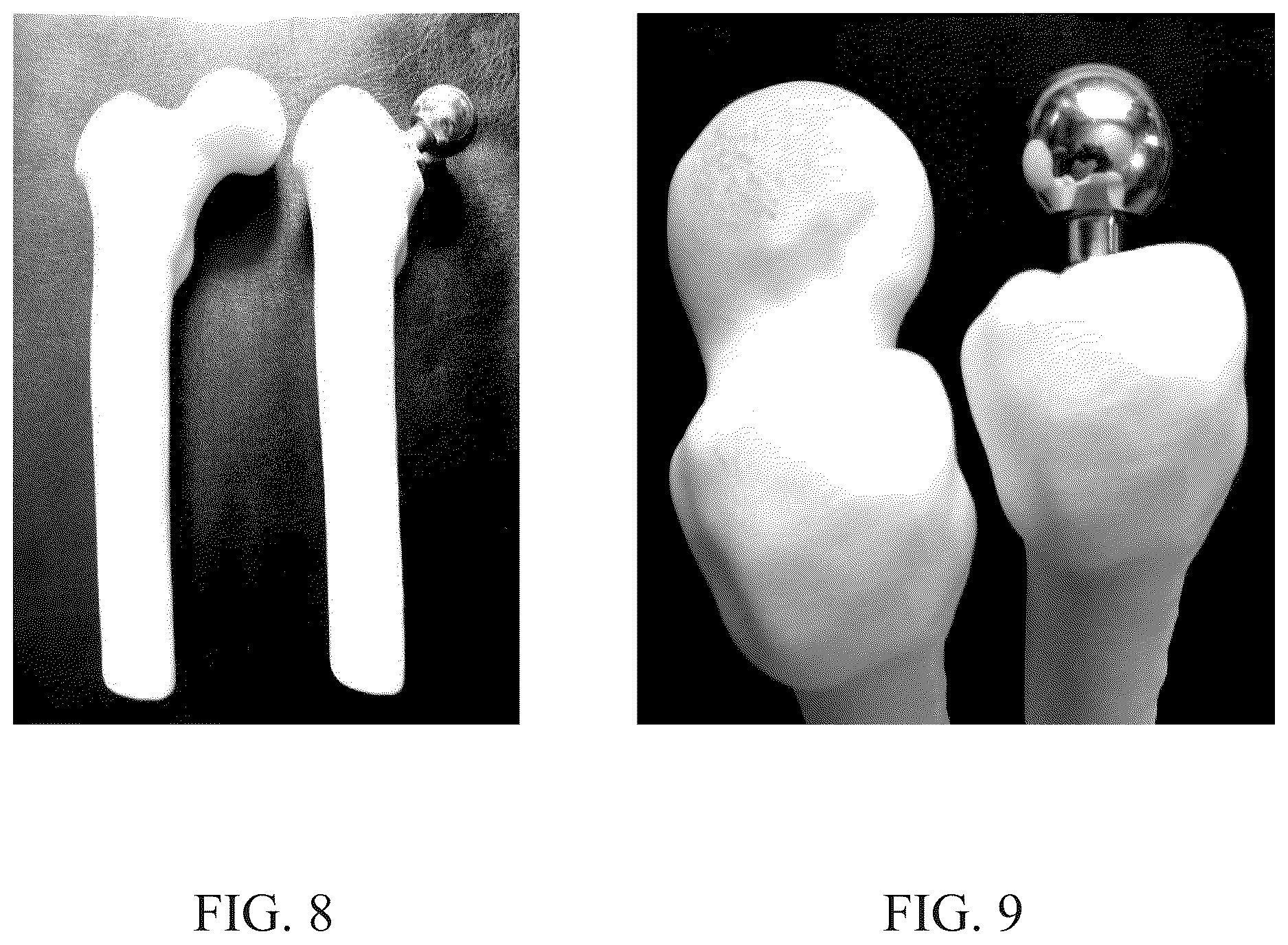 Patent US12611309 Figure 7 – Short implanted prosthesis and method of making same
