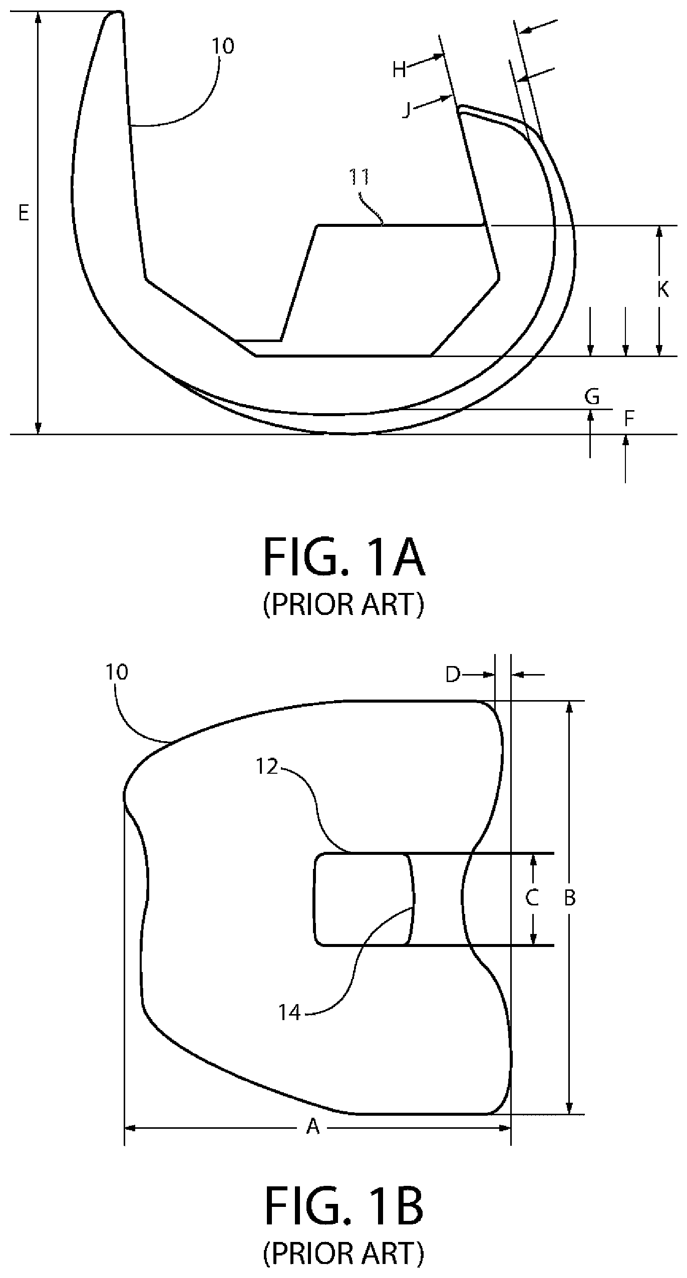 Patent US12611310 — Modular artificial knee system — Figure 1