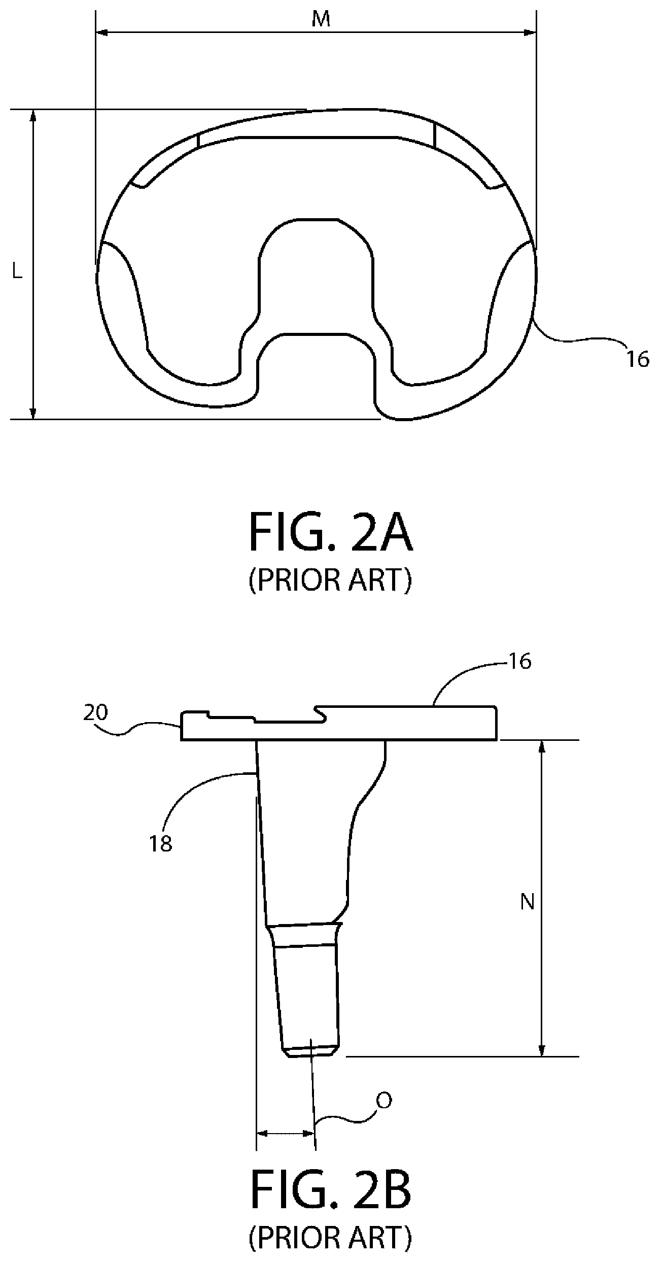 Patent US12611310 Figure 2 – Modular artificial knee system
