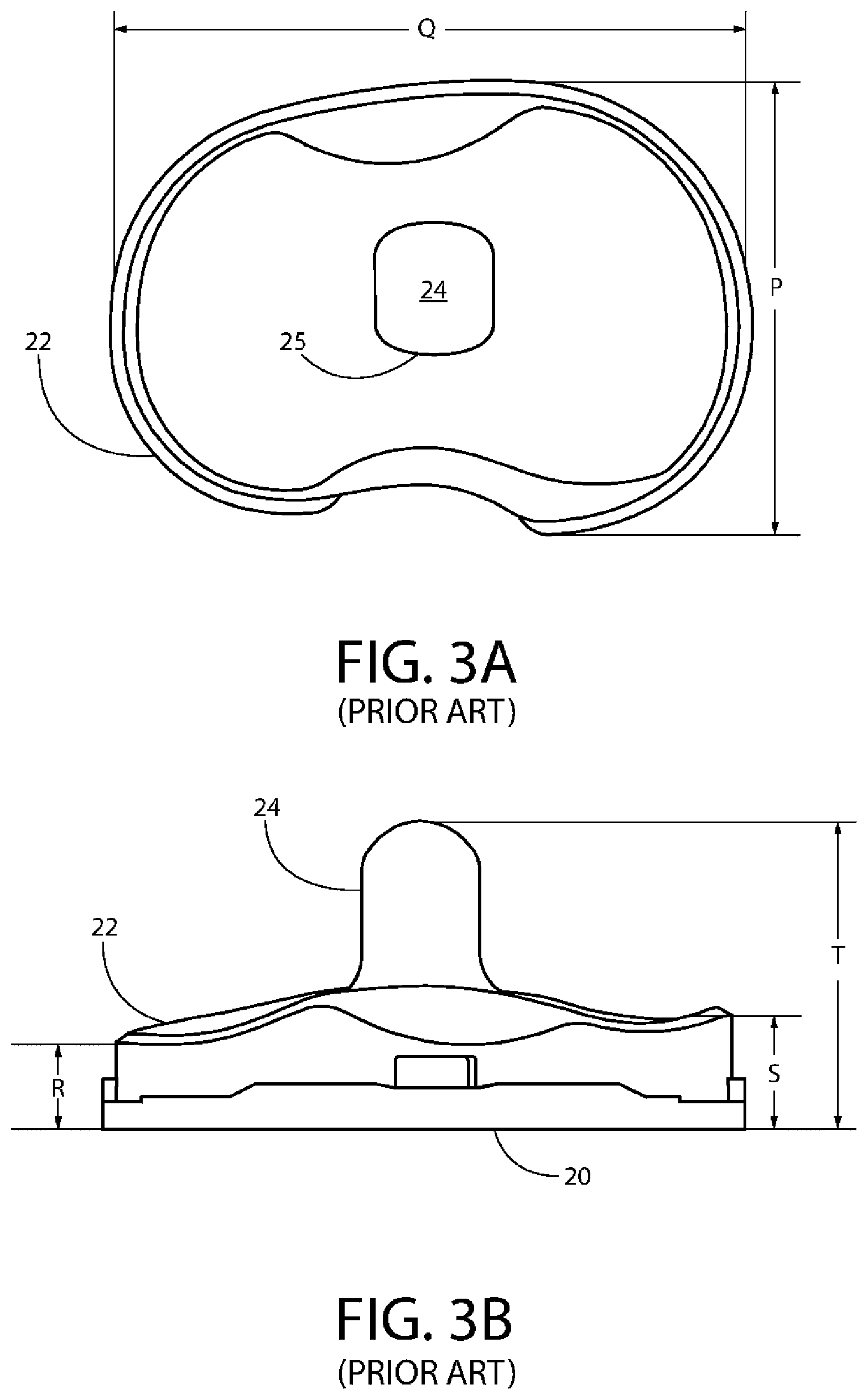 Patent US12611310 Figure 3 – Modular artificial knee system