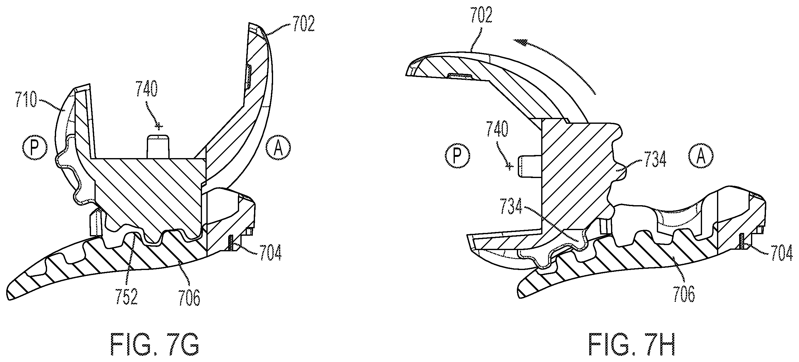 Patent US12611310 Figure 9 – Modular artificial knee system