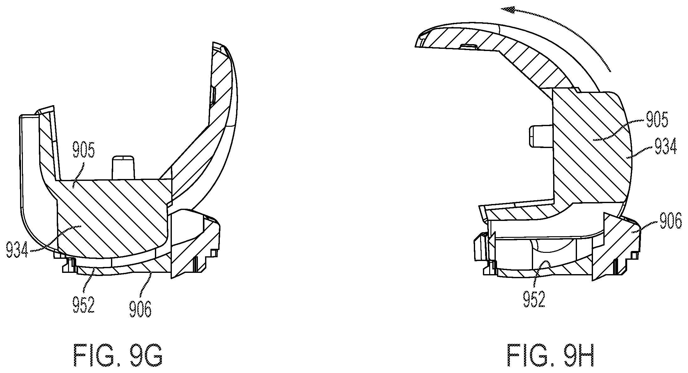 Patent US12611310 Figure 15 – Modular artificial knee system