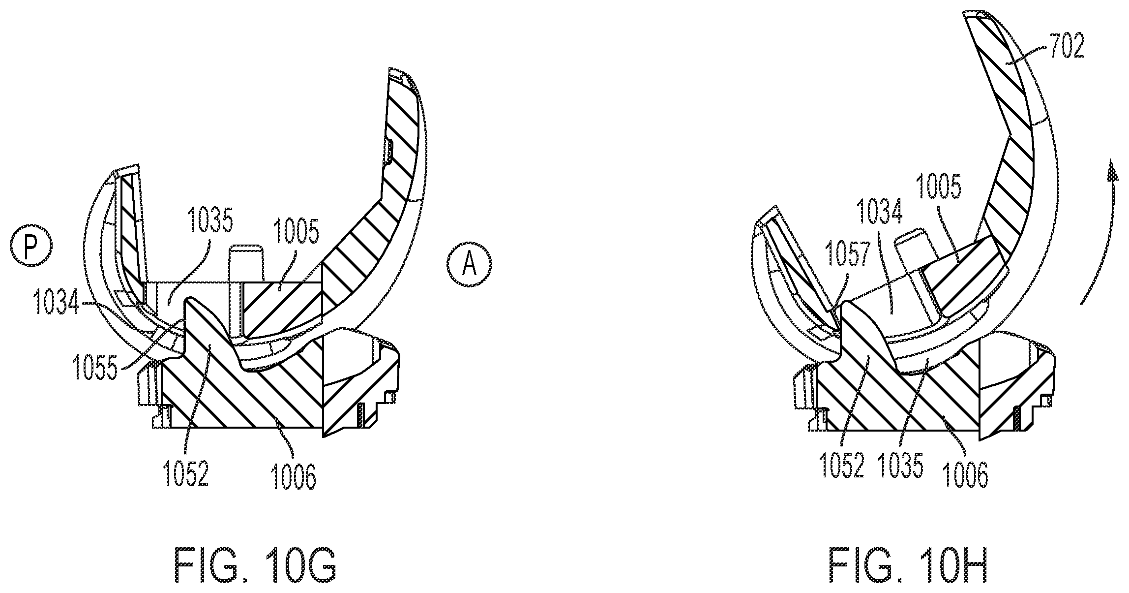 Patent US12611310 Figure 18 – Modular artificial knee system