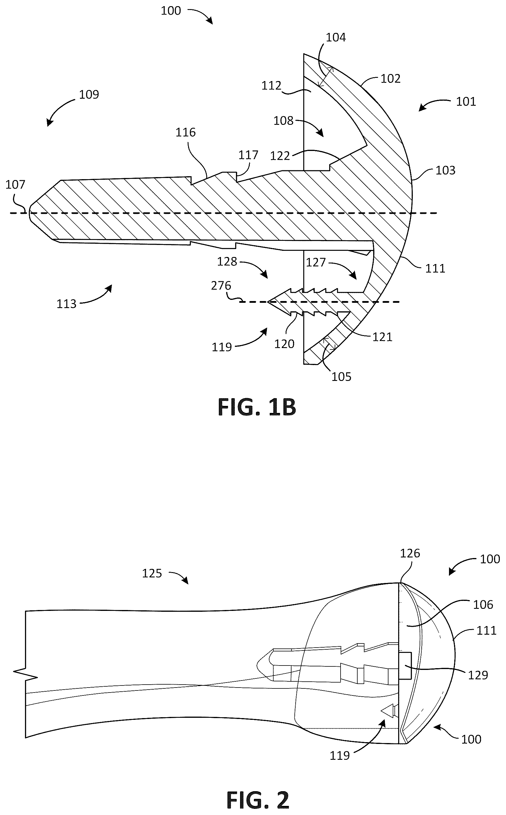 Patent US12611311 Figure 2 – Metatarsal arthroplasty devices, systems, and methods