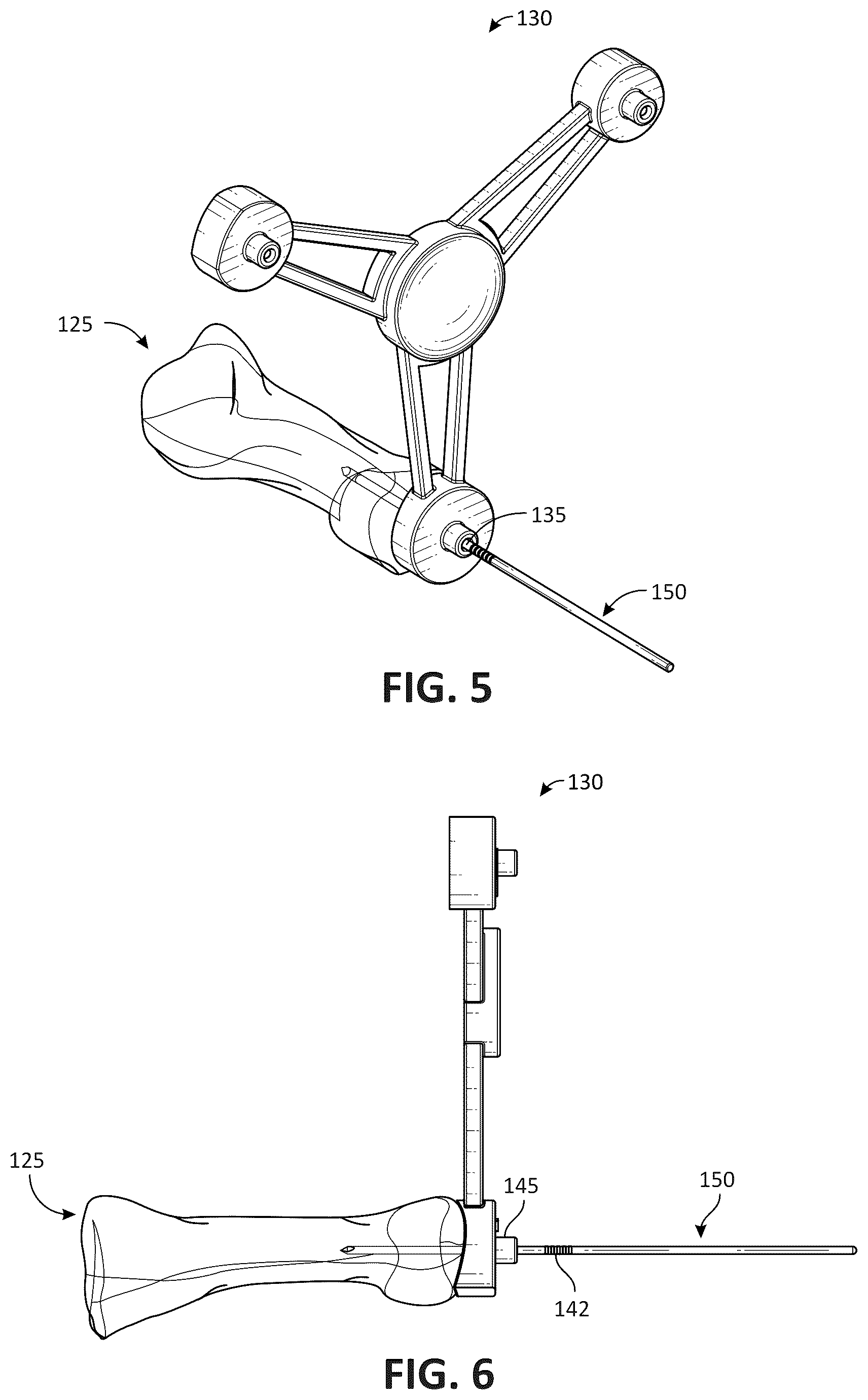 Patent US12611311 Figure 4 – Metatarsal arthroplasty devices, systems, and methods