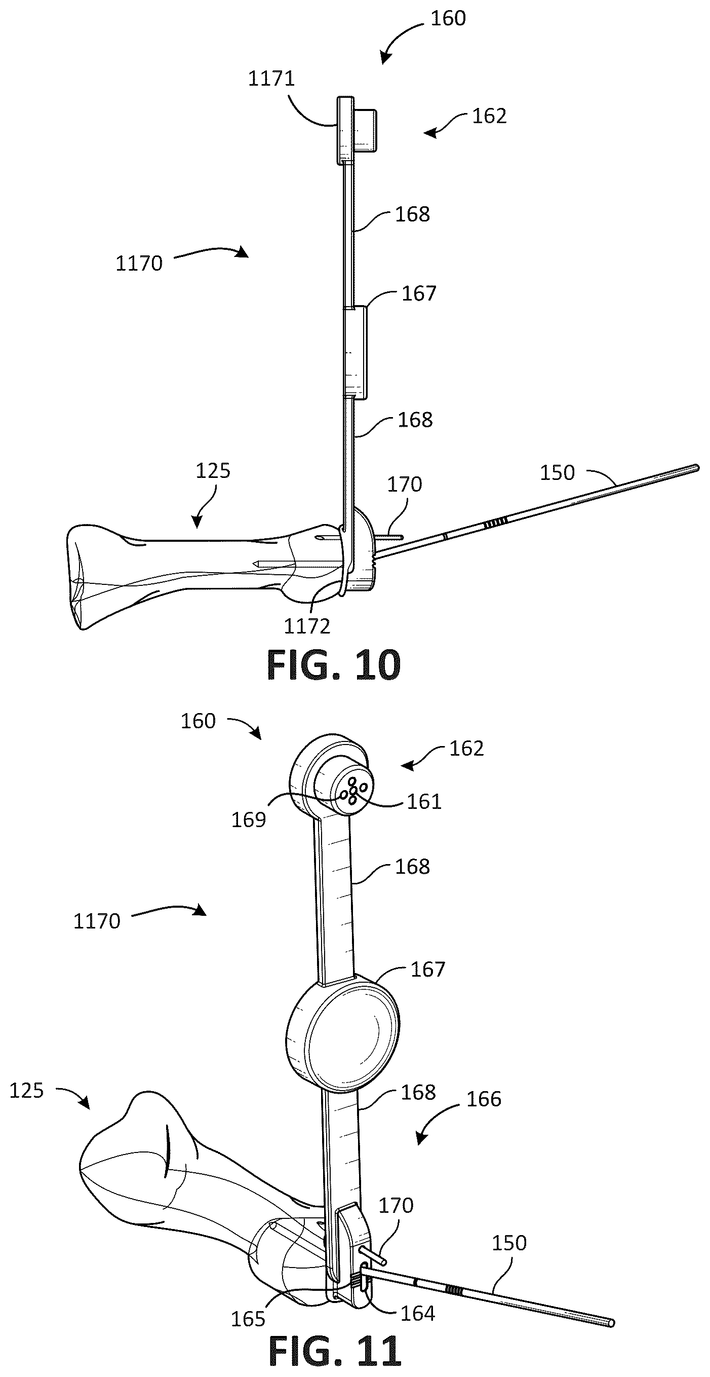 Patent US12611311 Figure 6 – Metatarsal arthroplasty devices, systems, and methods