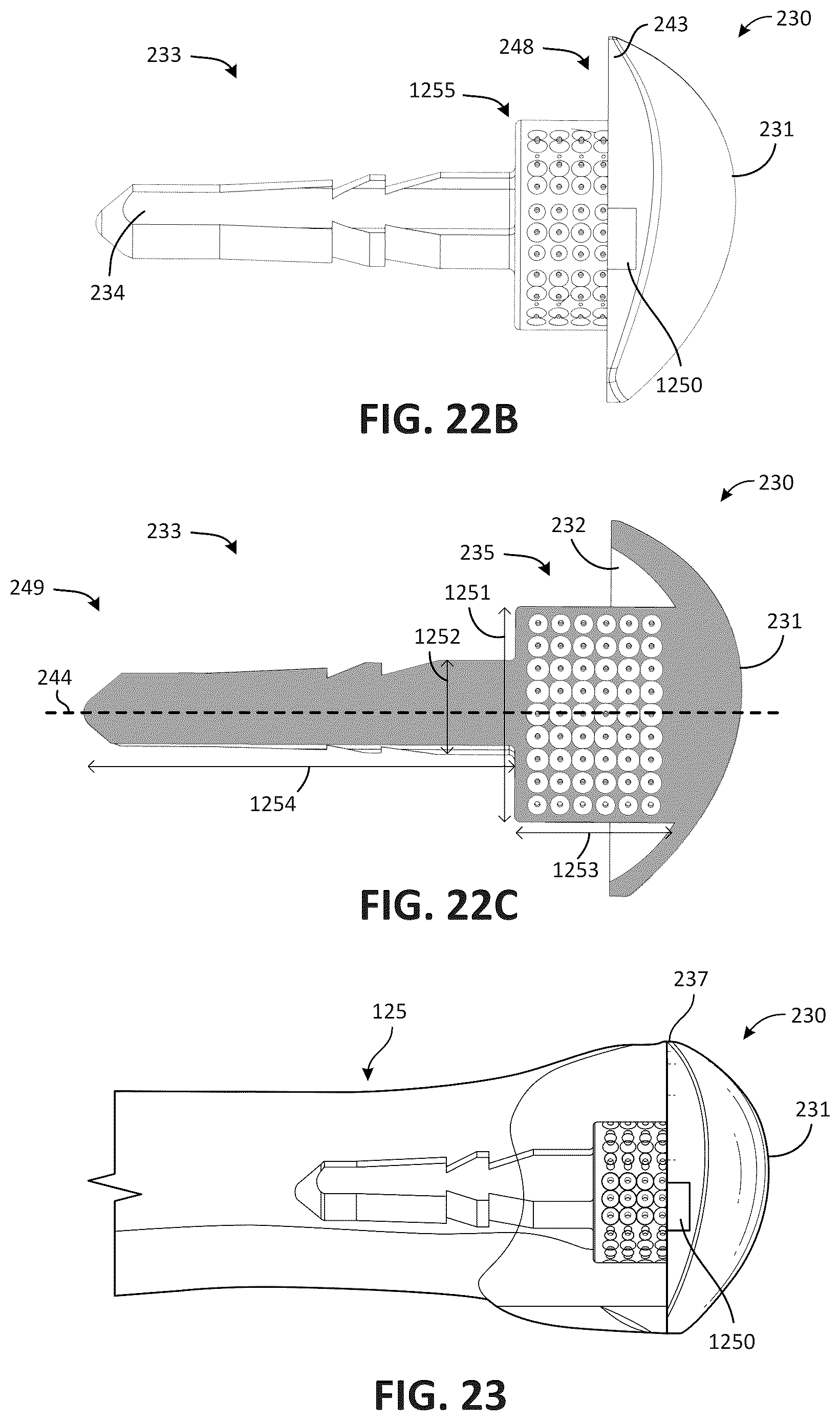 Patent US12611311 Figure 13 – Metatarsal arthroplasty devices, systems, and methods