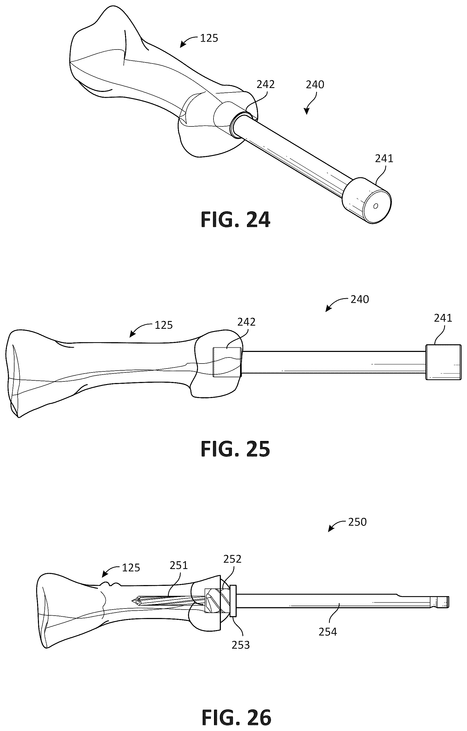 Patent US12611311 Figure 14 – Metatarsal arthroplasty devices, systems, and methods