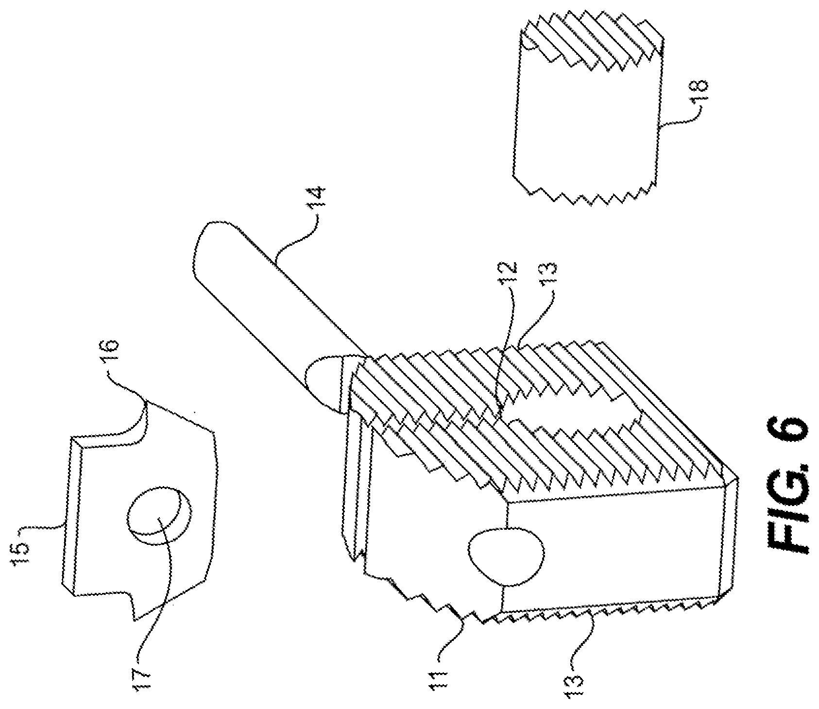Patent US12611312 Figure 6 – Medical implant for fixation and integration with hard tissue