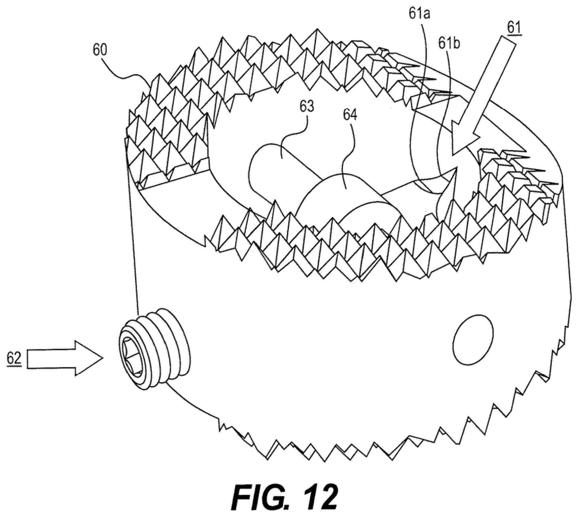 Patent US12611312 Figure 12 – Medical implant for fixation and integration with hard tissue
