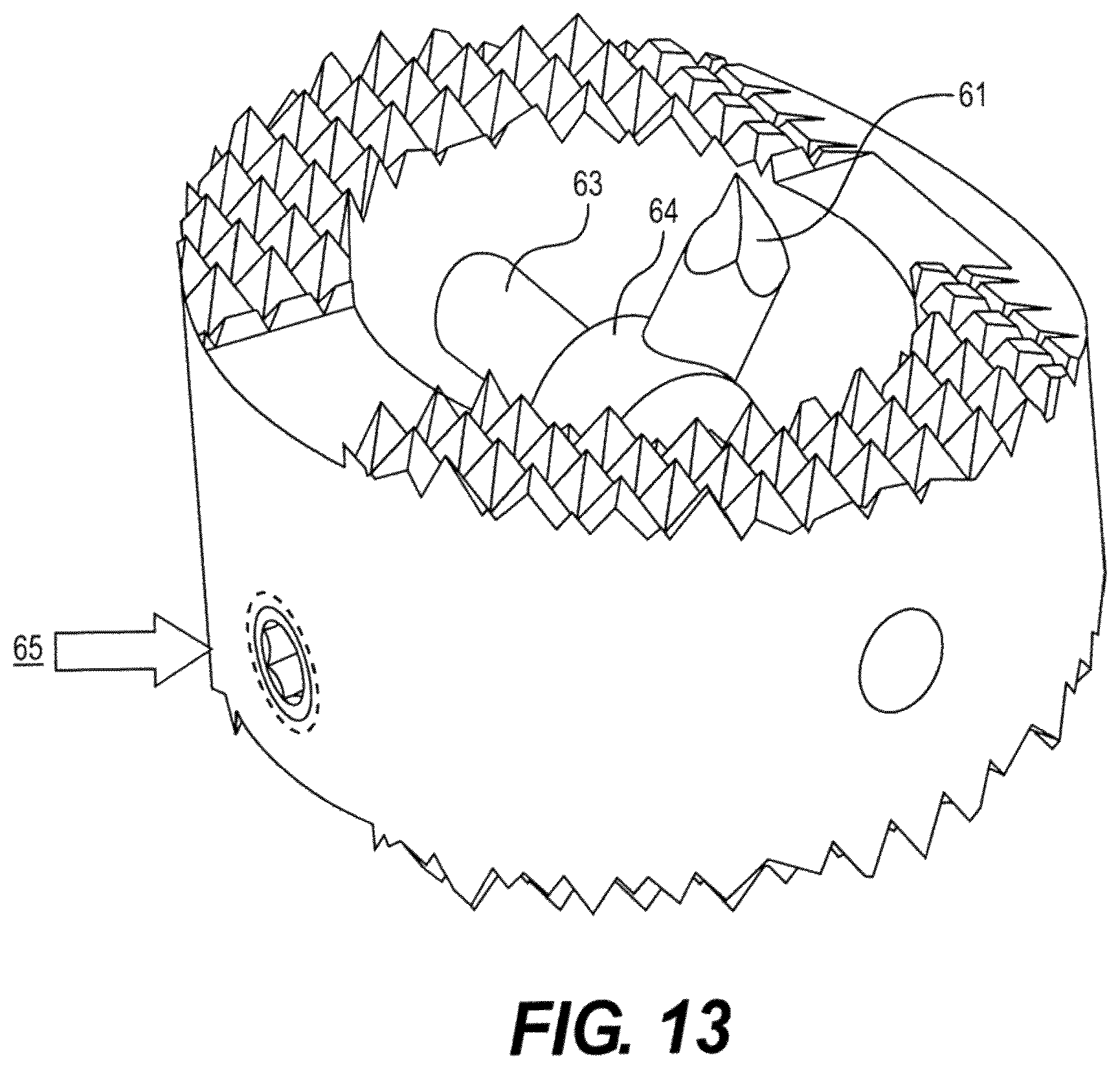 Patent US12611312 Figure 13 – Medical implant for fixation and integration with hard tissue