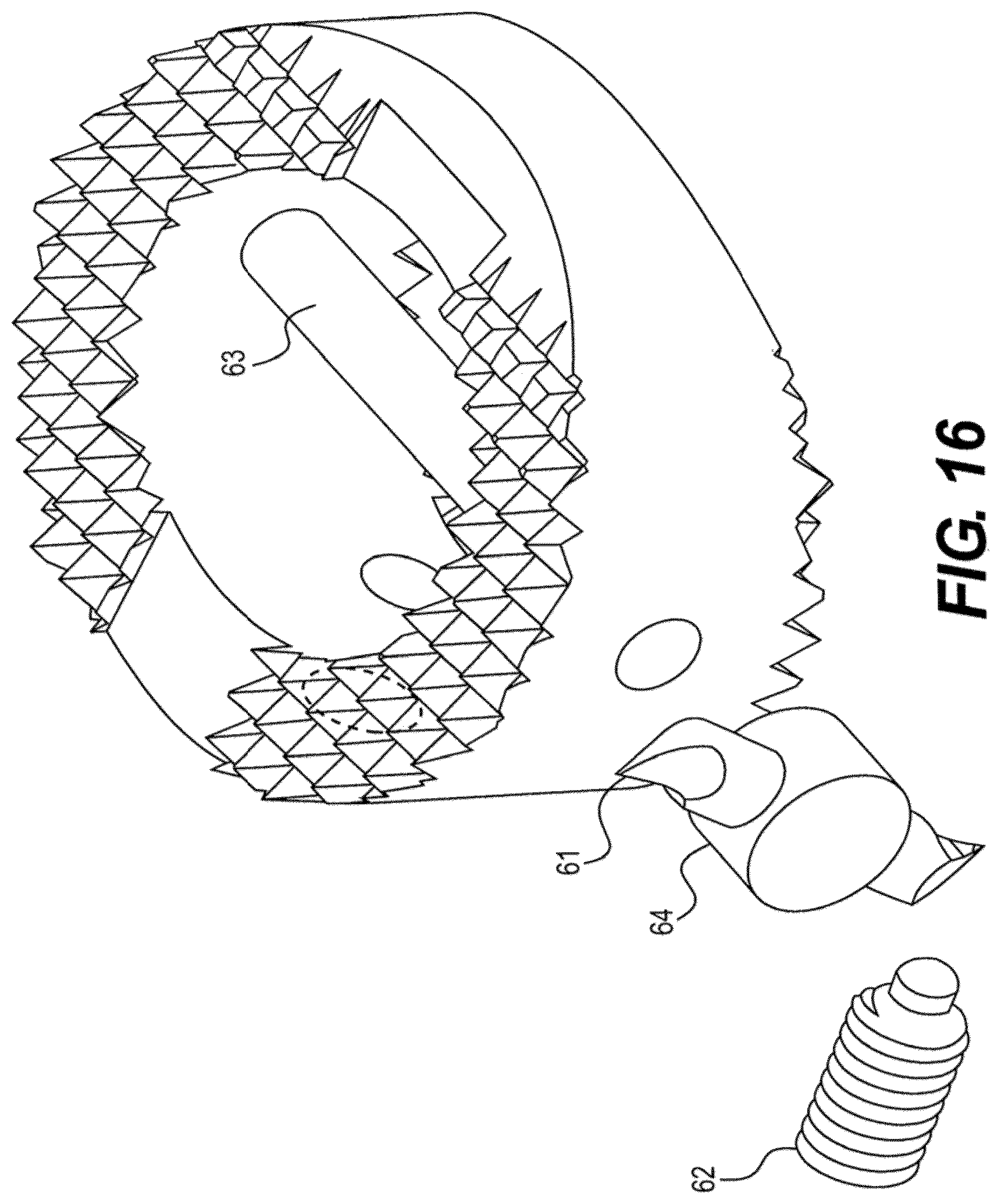 Patent US12611312 Figure 16 – Medical implant for fixation and integration with hard tissue