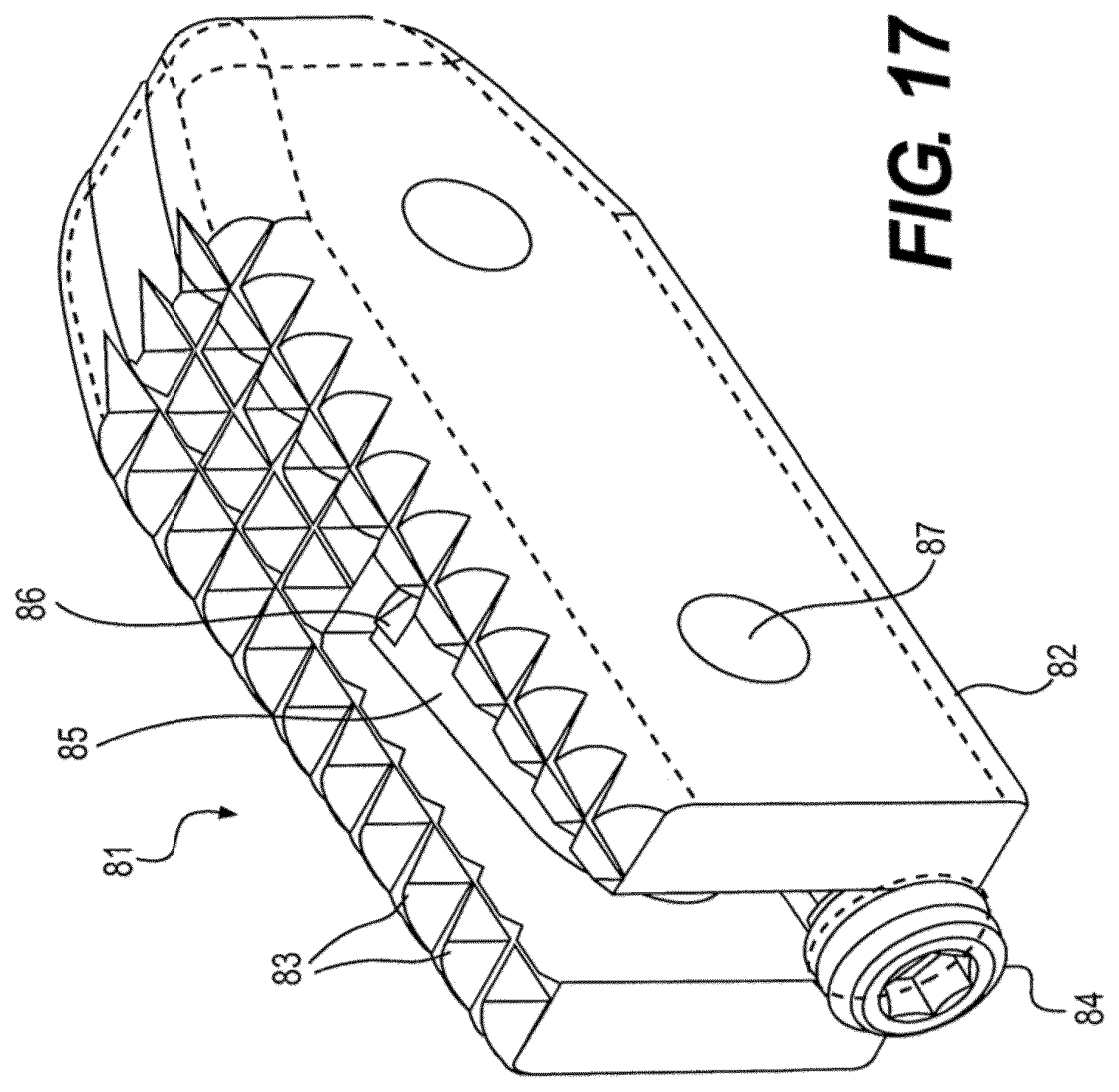 Patent US12611312 Figure 17 – Medical implant for fixation and integration with hard tissue