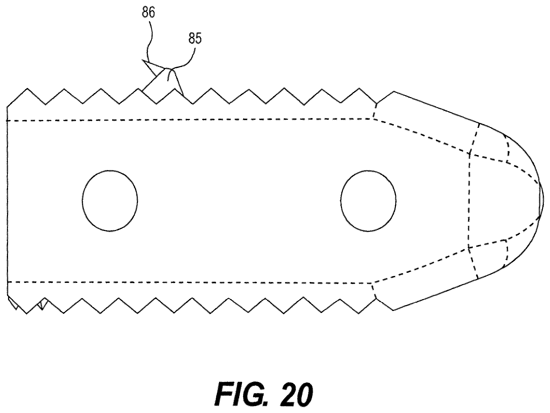 Patent US12611312 Figure 20 – Medical implant for fixation and integration with hard tissue