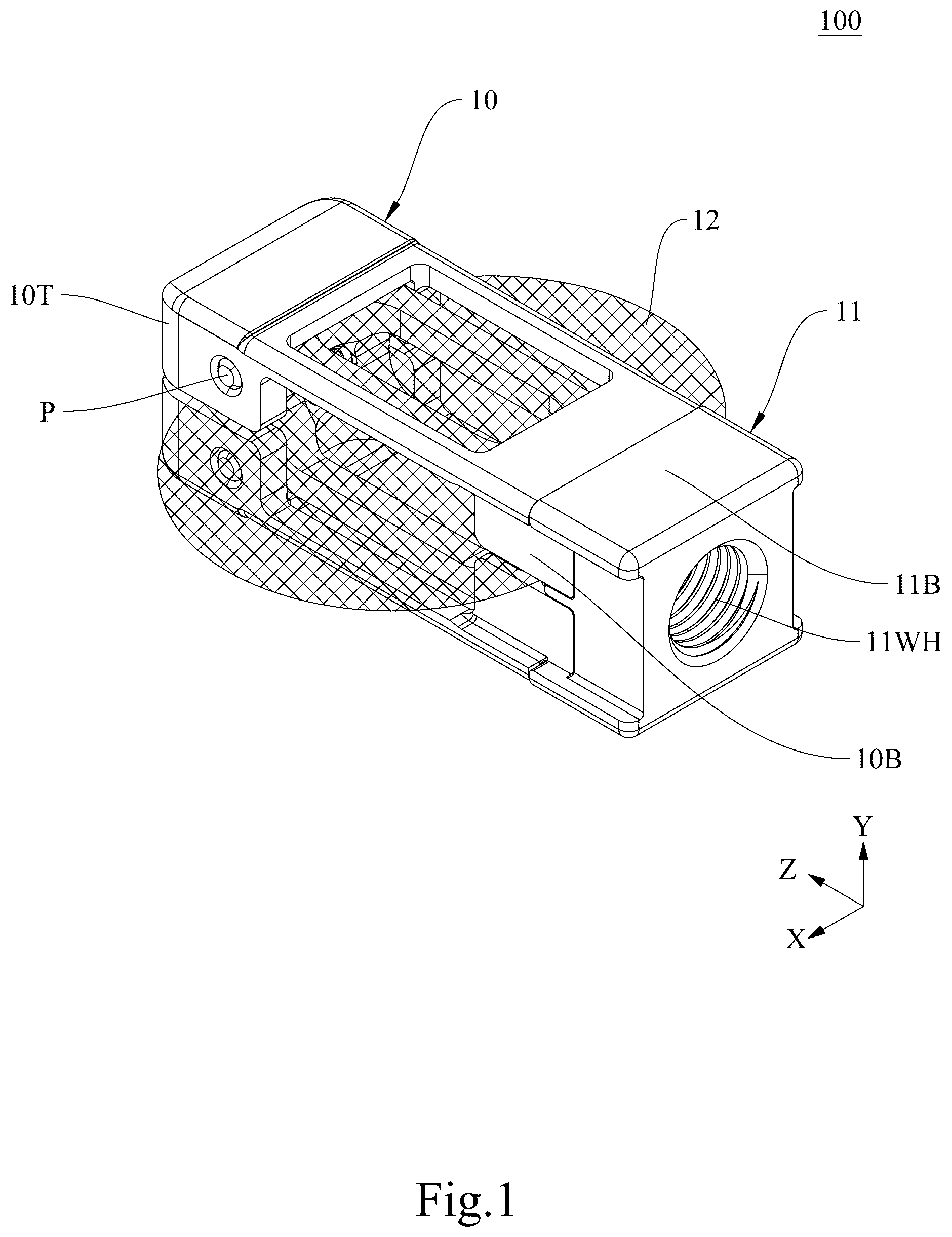 Patent US12611314 Figure 1 – Intervertebral implant and device and system comprising the same
