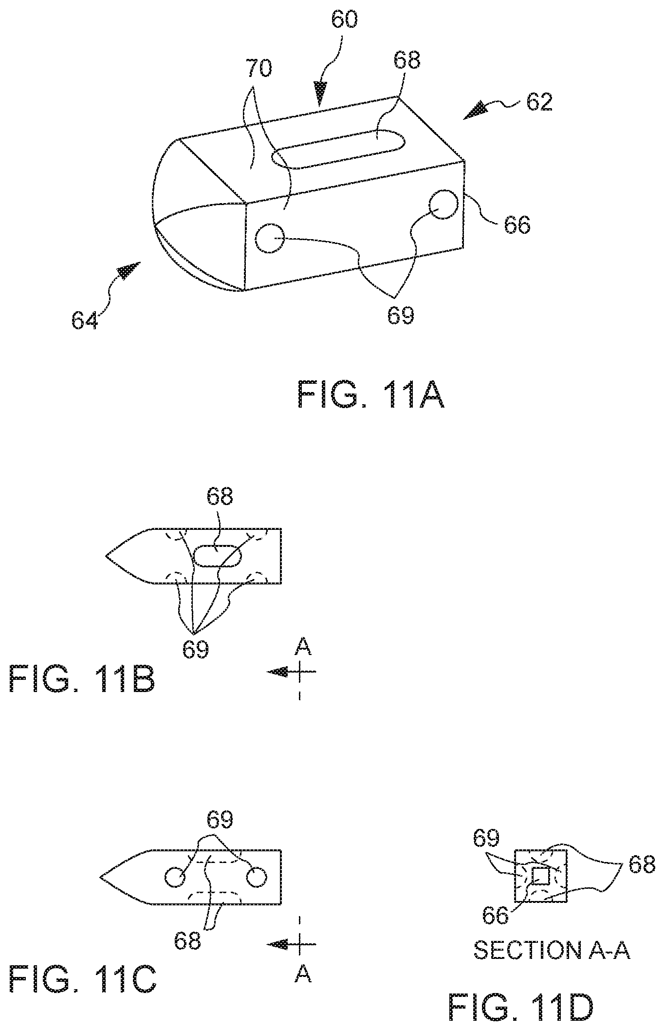 Patent US12611315 Figure 5 – Bone graft delivery system and method for using same