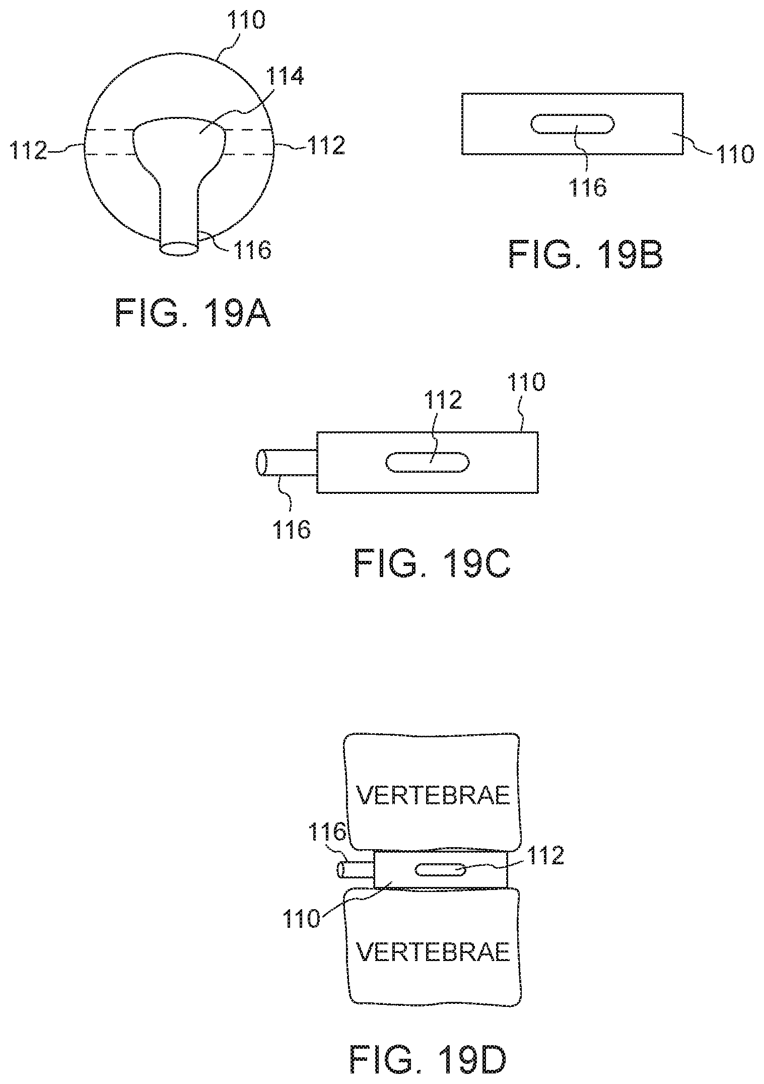Patent US12611315 Figure 11 – Bone graft delivery system and method for using same