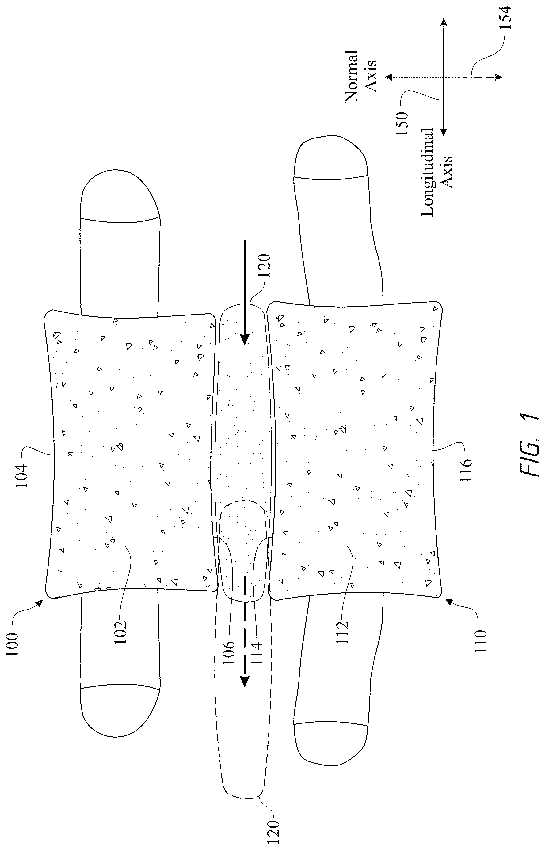 Patent US12611316 — Intervertebral members and methods of using a bone reinforcing composition for retaining the intervertebral members — Figure 1