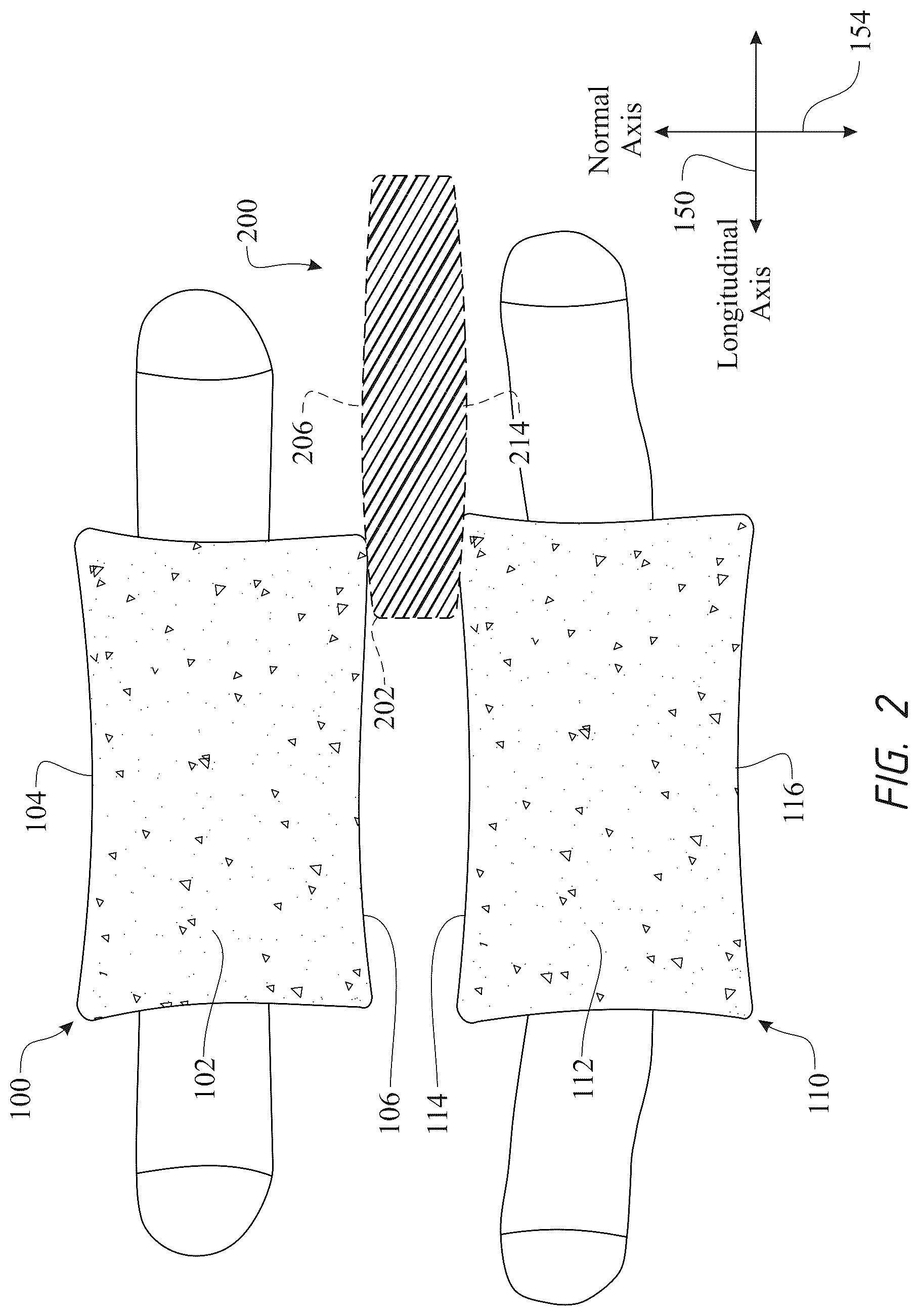 Patent US12611316 Figure 2 – Intervertebral members and methods of using a bone reinforcing composition for retaining the intervertebral members