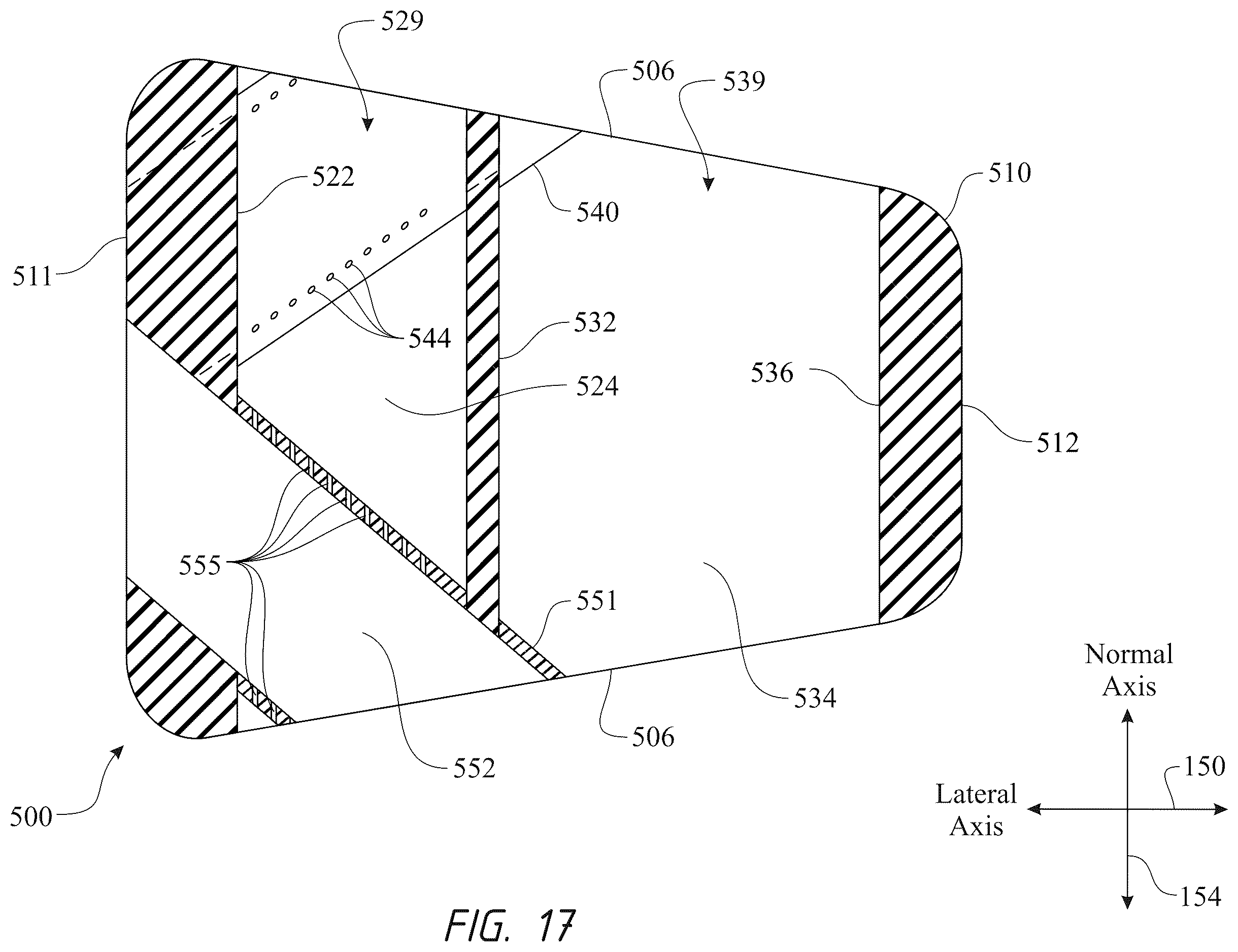 Patent US12611316 Figure 17 – Intervertebral members and methods of using a bone reinforcing composition for retaining the intervertebral members
