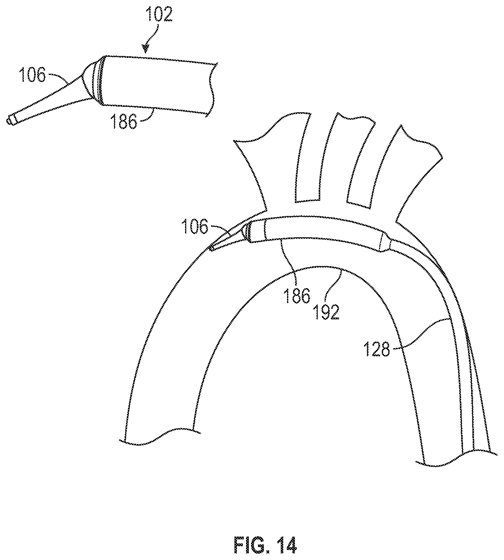 Patent US12611321 Figure 9 – Delivery apparatus having nosecone with pivotable end portion