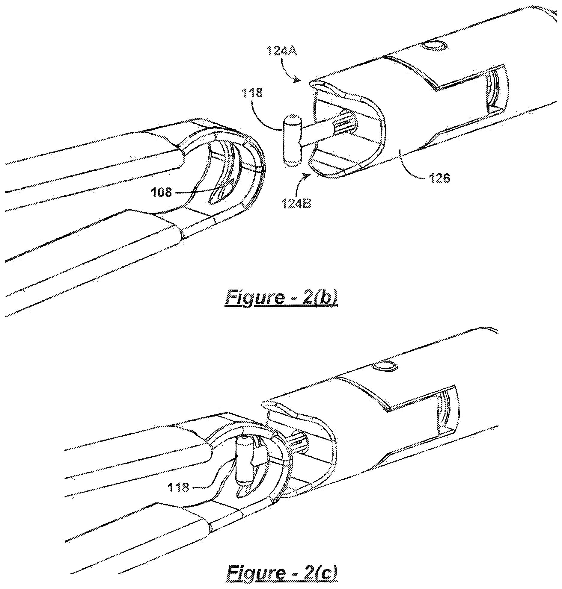 Patent US12611323 Figure 2 – Inflatable bariatric clamp