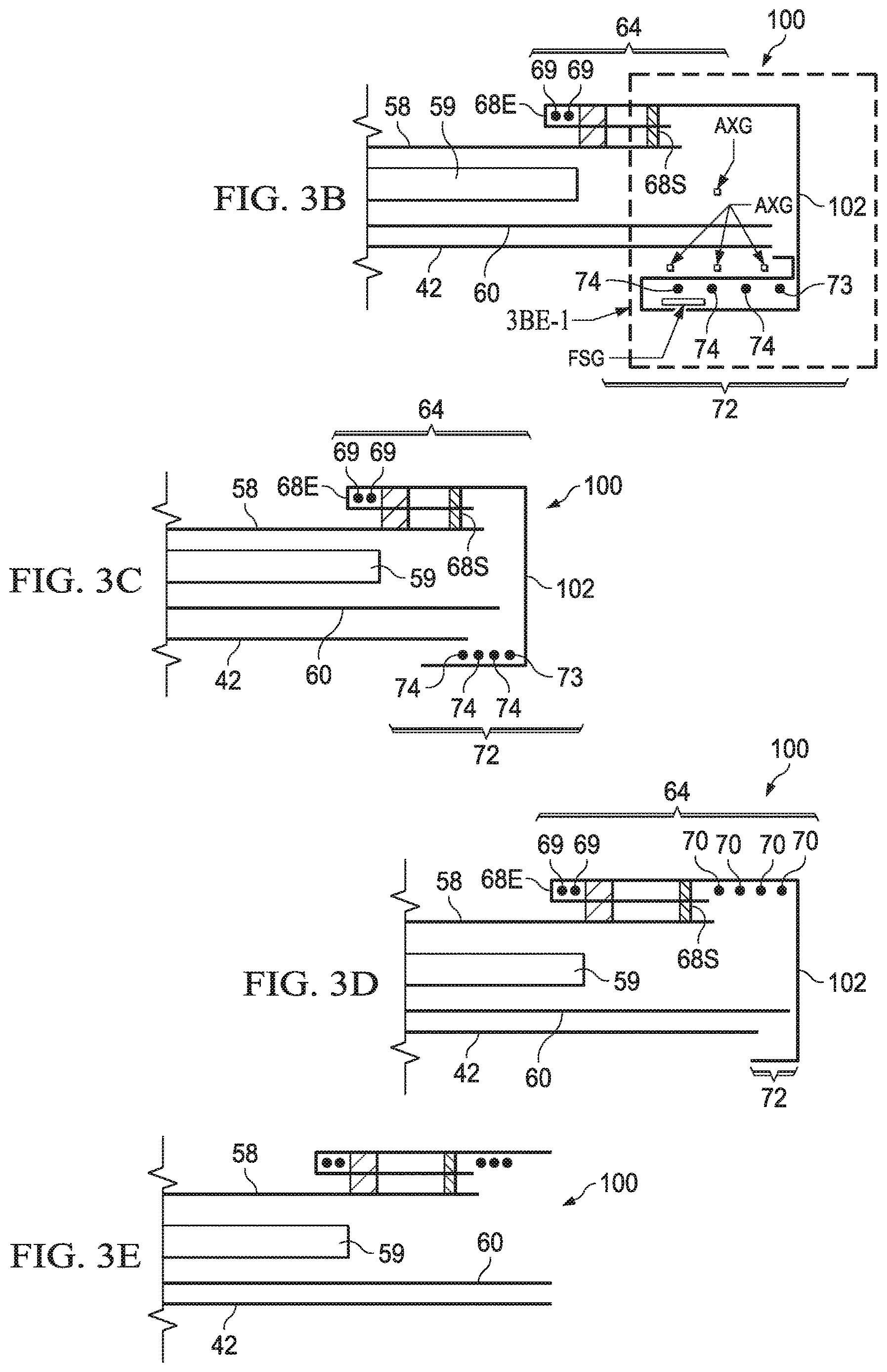 Patent US12611337 Figure 5 – Absorbent article with leg gasketing system