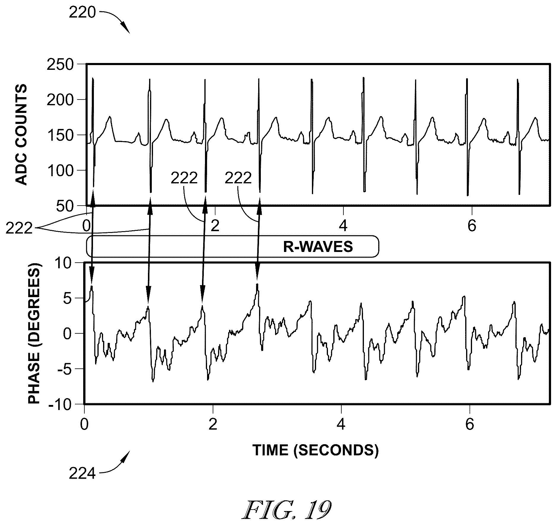 Patent US12611347 Figure 12 – Mattress degradation determination using radar