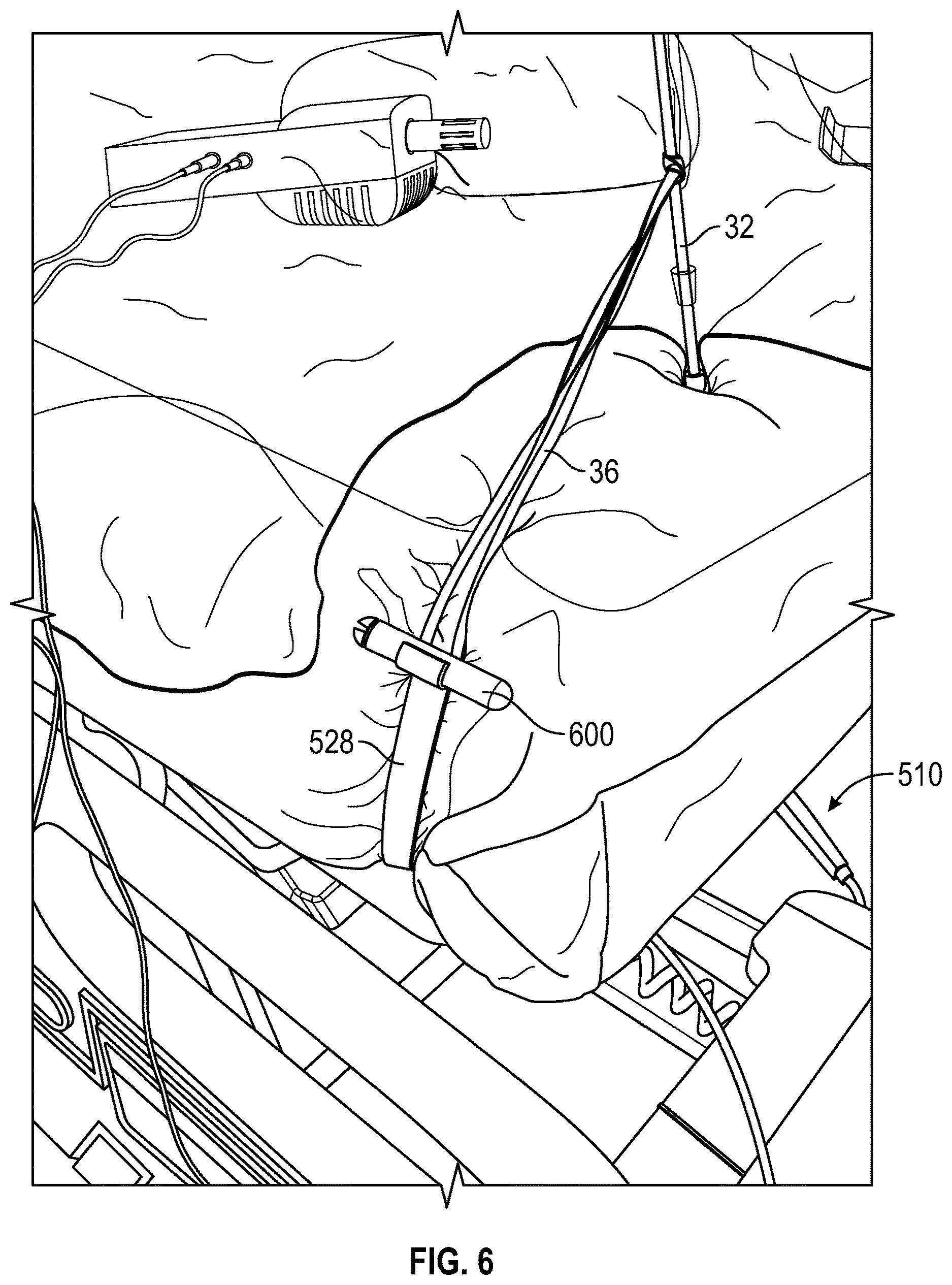 Patent US12611349 Figure 5 – Aerosol containment enclosure