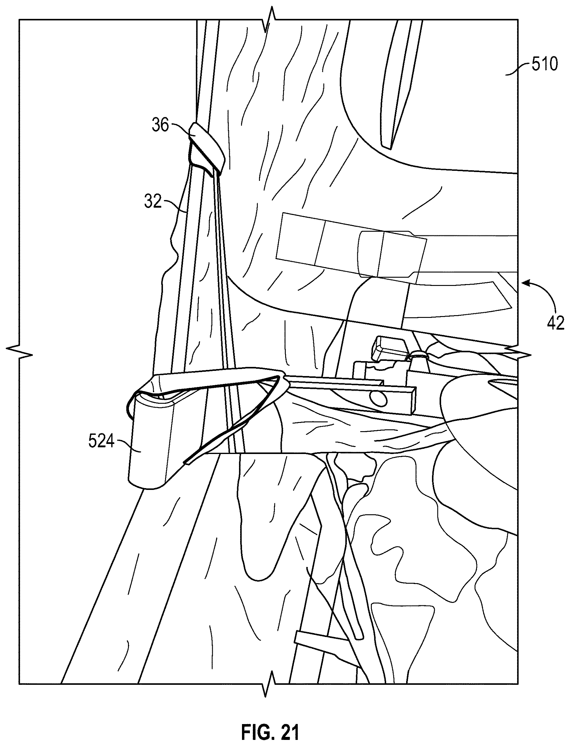 Patent US12611349 Figure 13 – Aerosol containment enclosure