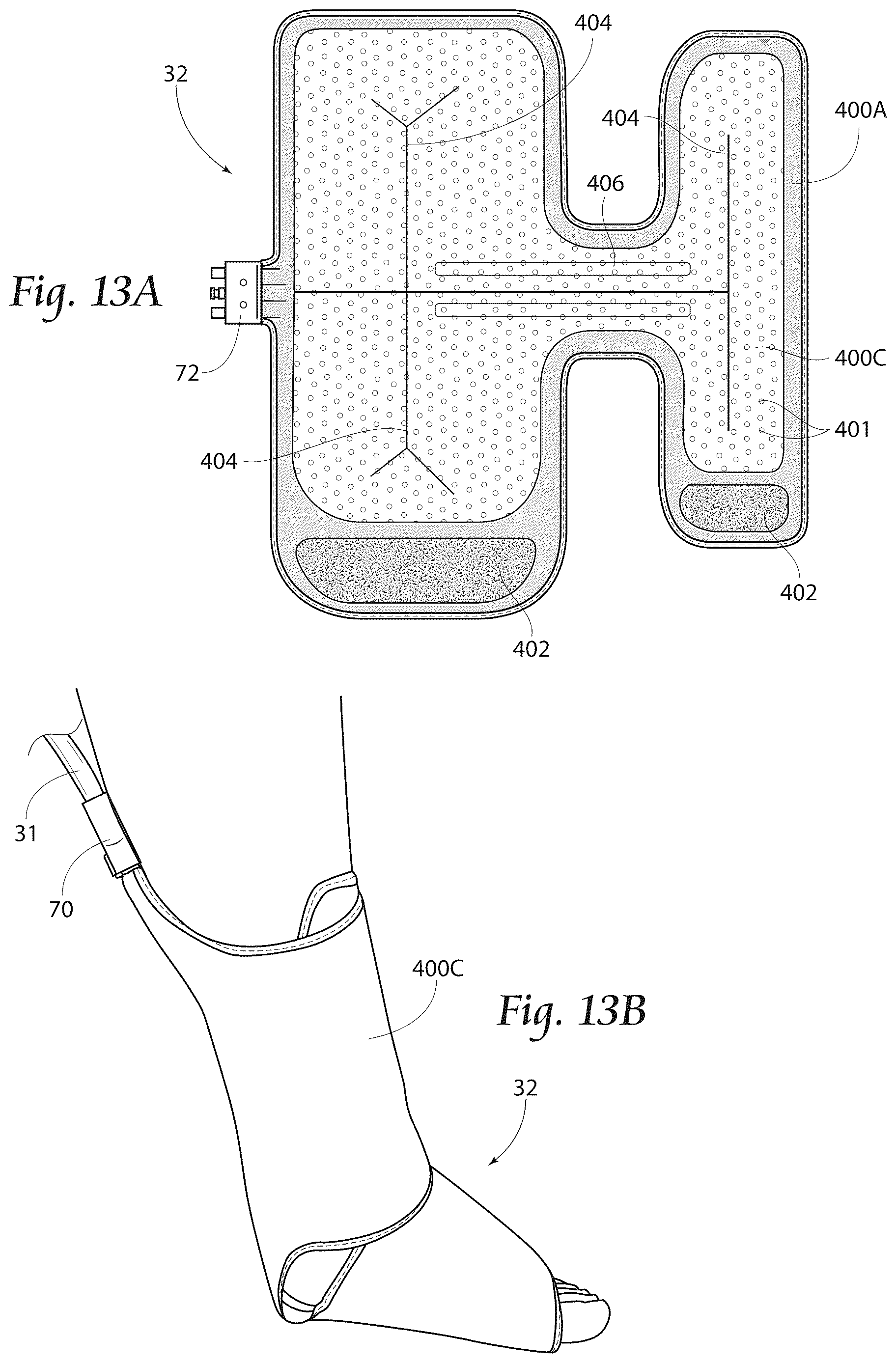 Patent US12611355 Figure 6 – System and method for heat or cold therapy and compression therapy