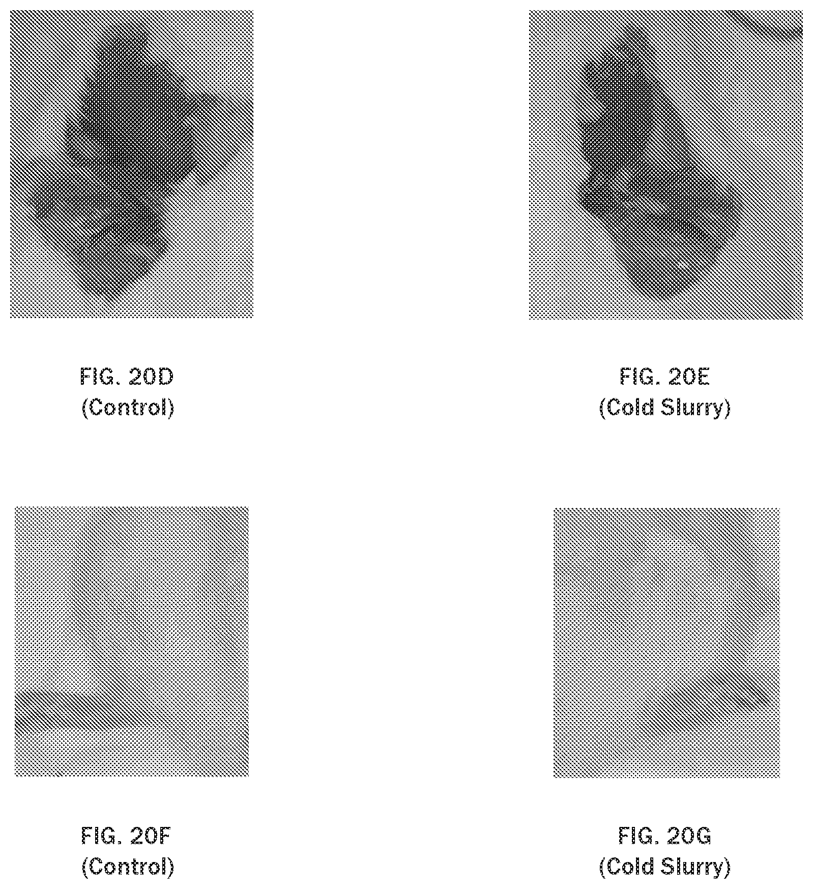 Patent US12611375 Figure 18 – Injectable slurries and methods of manufacturing the same