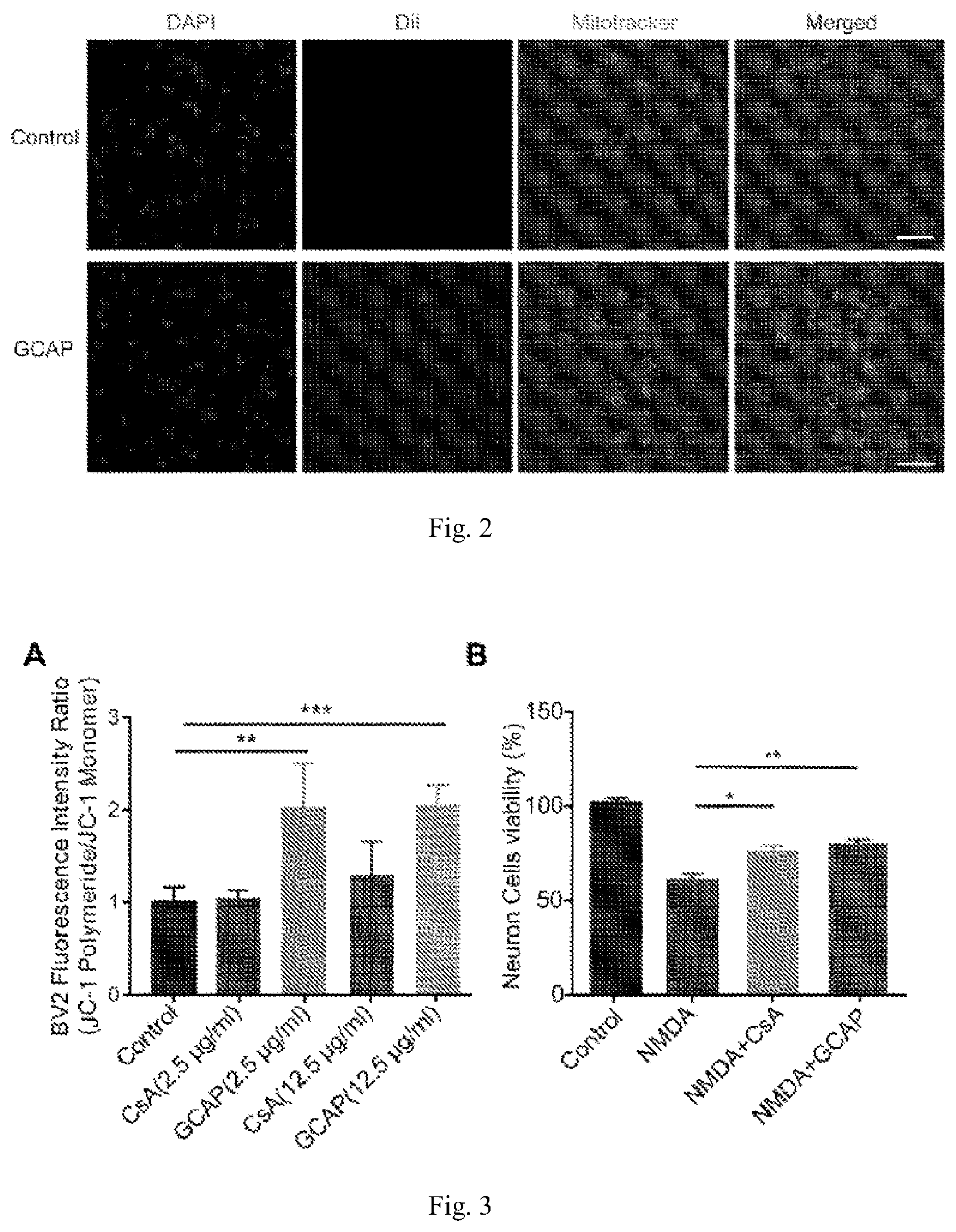 Patent US12611379 Figure 2 – Lipid nano drug delivery system targeting brain lesion and preparation method and application thereof