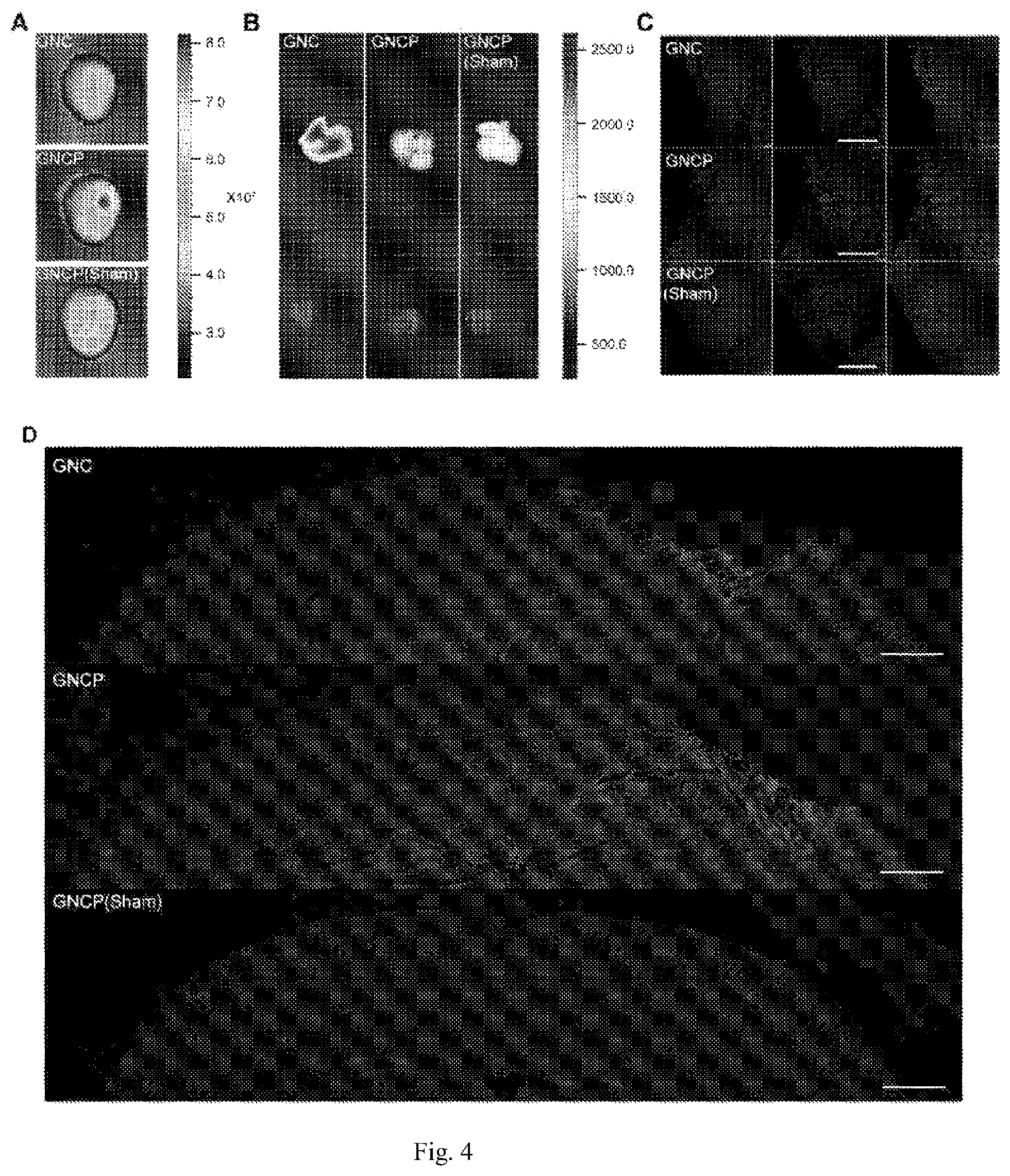 Patent US12611379 Figure 3 – Lipid nano drug delivery system targeting brain lesion and preparation method and application thereof