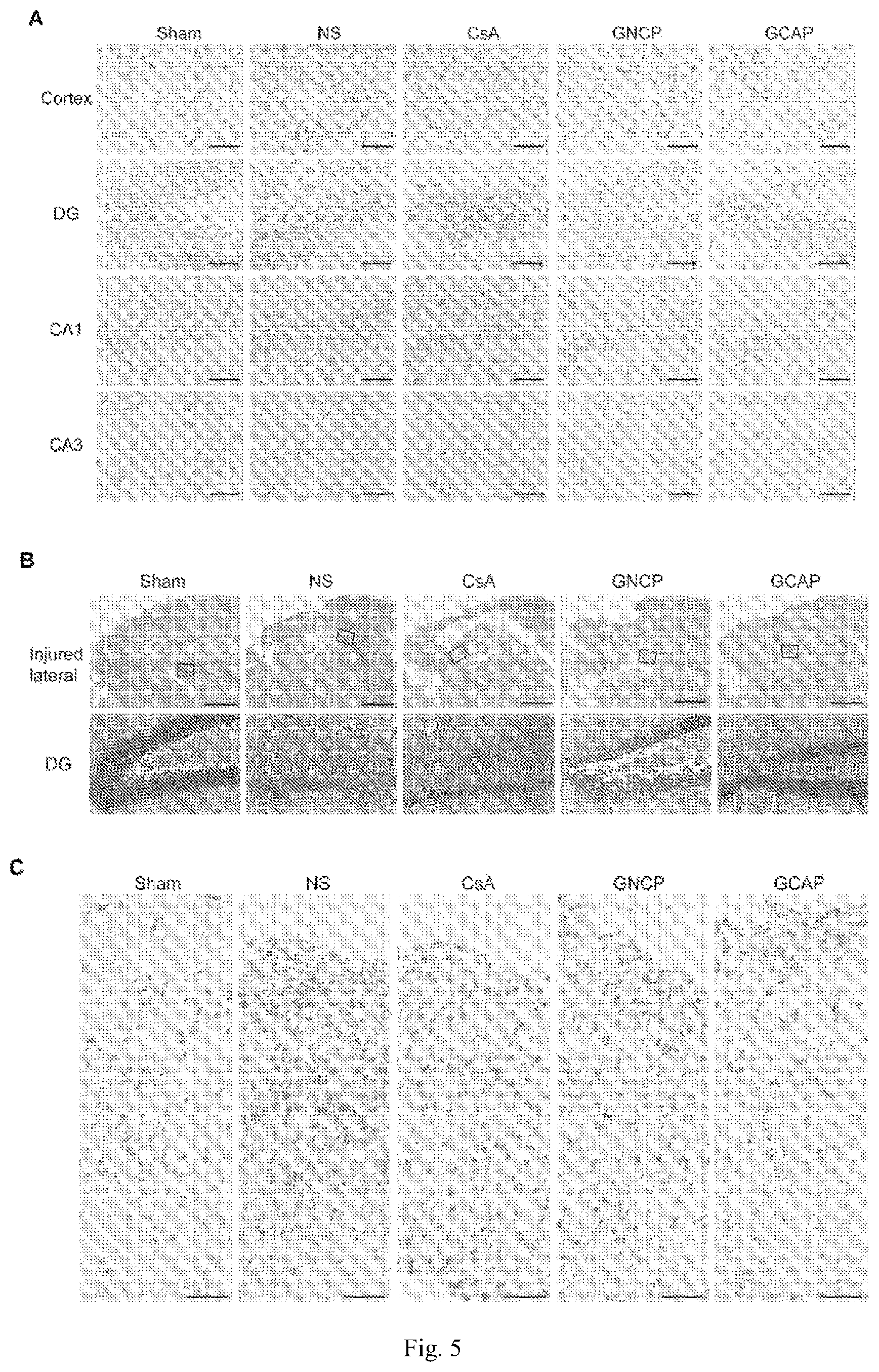 Patent US12611379 Figure 4 – Lipid nano drug delivery system targeting brain lesion and preparation method and application thereof
