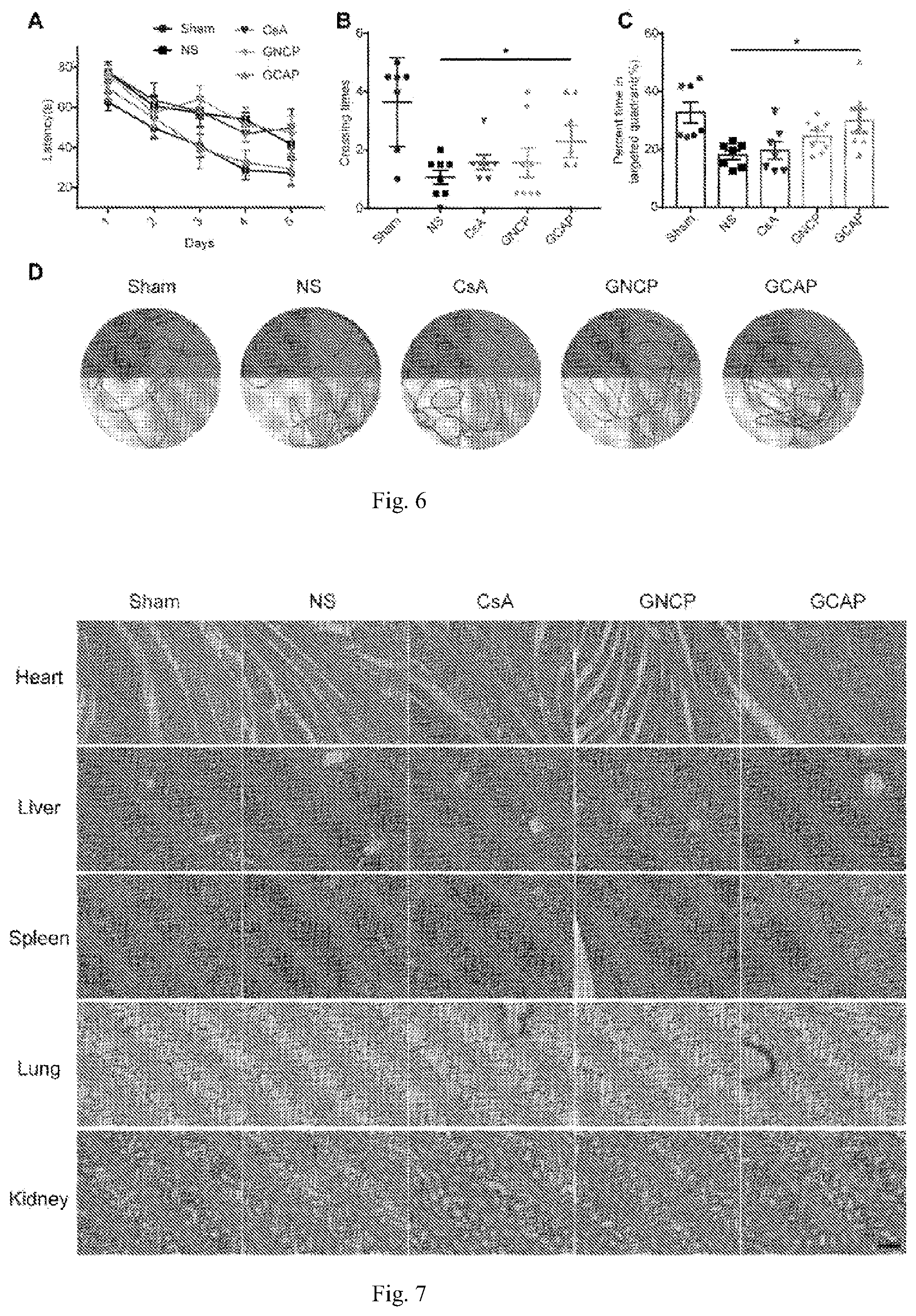 Patent US12611379 Figure 5 – Lipid nano drug delivery system targeting brain lesion and preparation method and application thereof