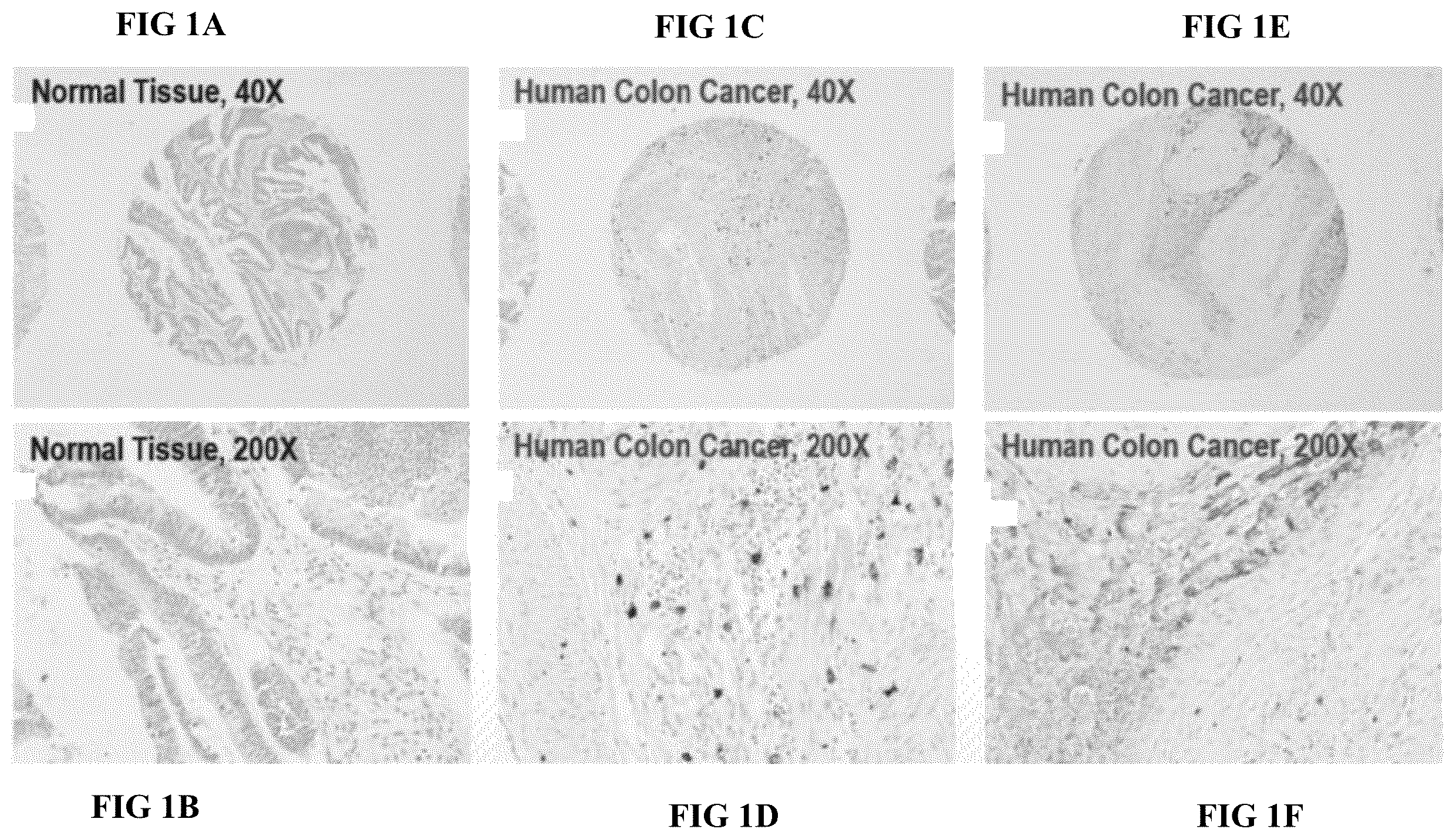 Patent US12611409 Figure 1 – Combination therapy using a chemokine receptor 2 (CCR2) antagonist and a PD-1/PD-L1 inhibitor