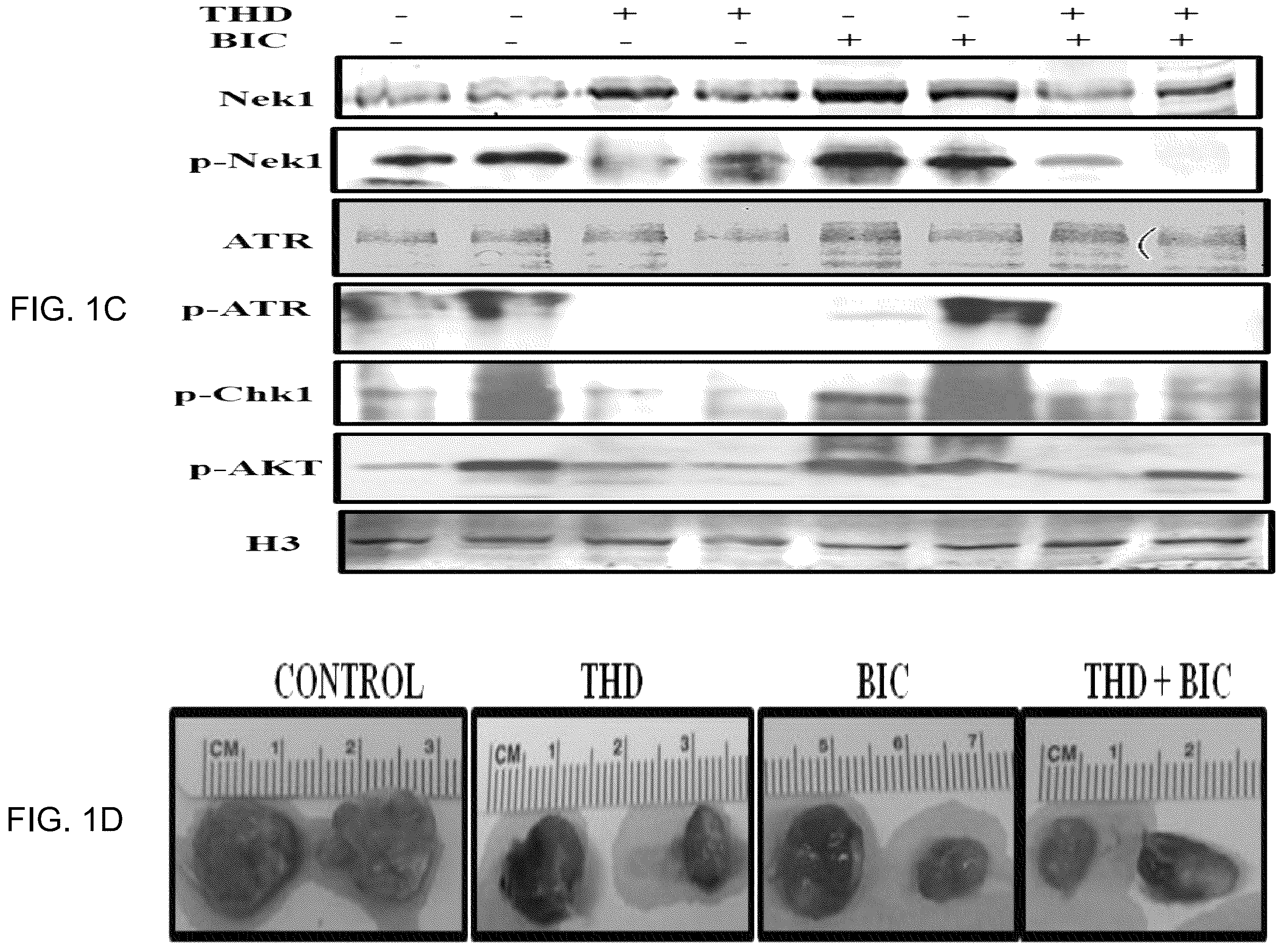 Patent US12611412 Figure 2 – Targeting the TLK1/NEK1 axis in prostate cancer