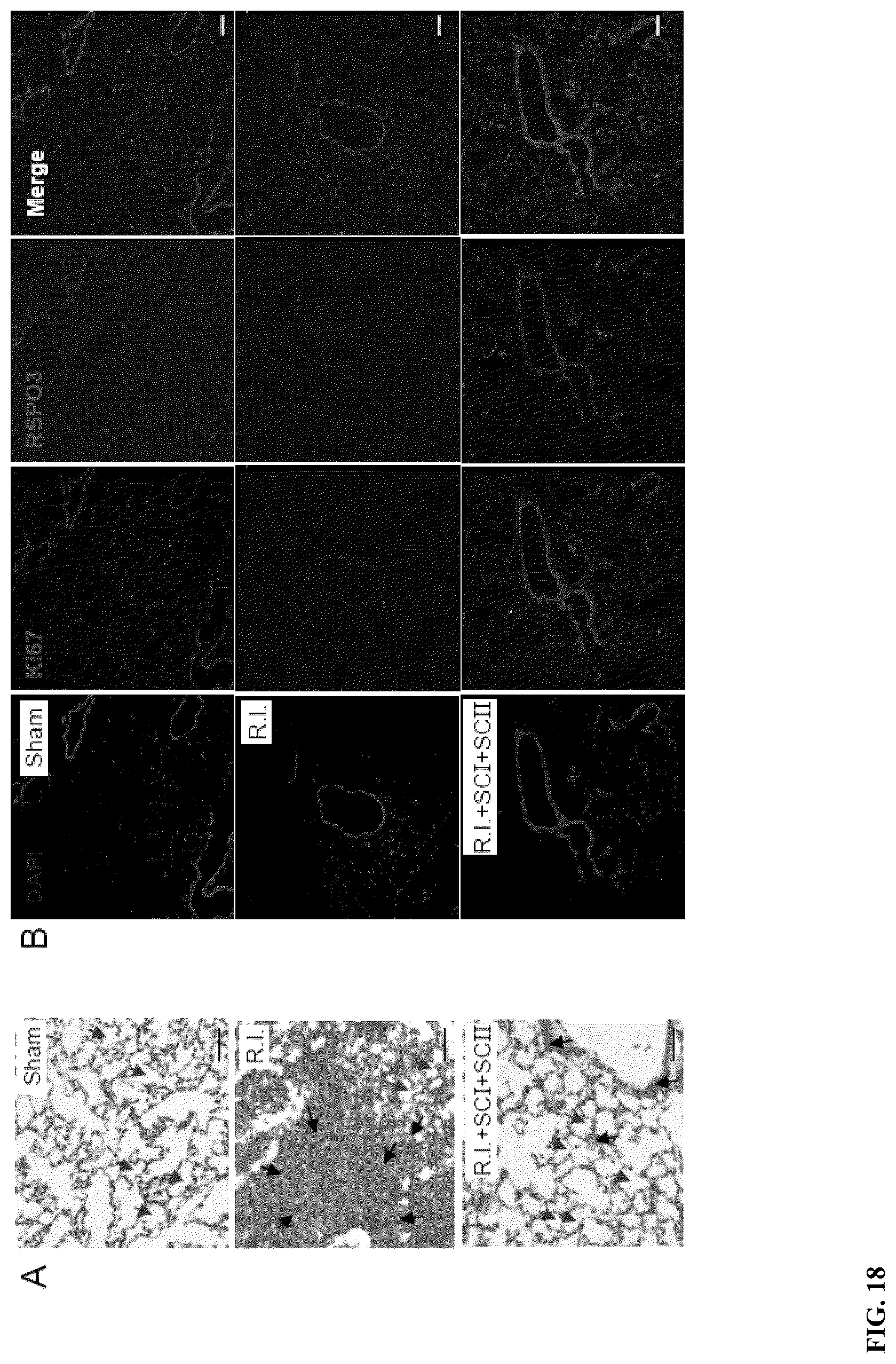 Patent US12611414 Figure 18 – Cysteinyl-proresolving mediators that promote resolution of infection and organ protection