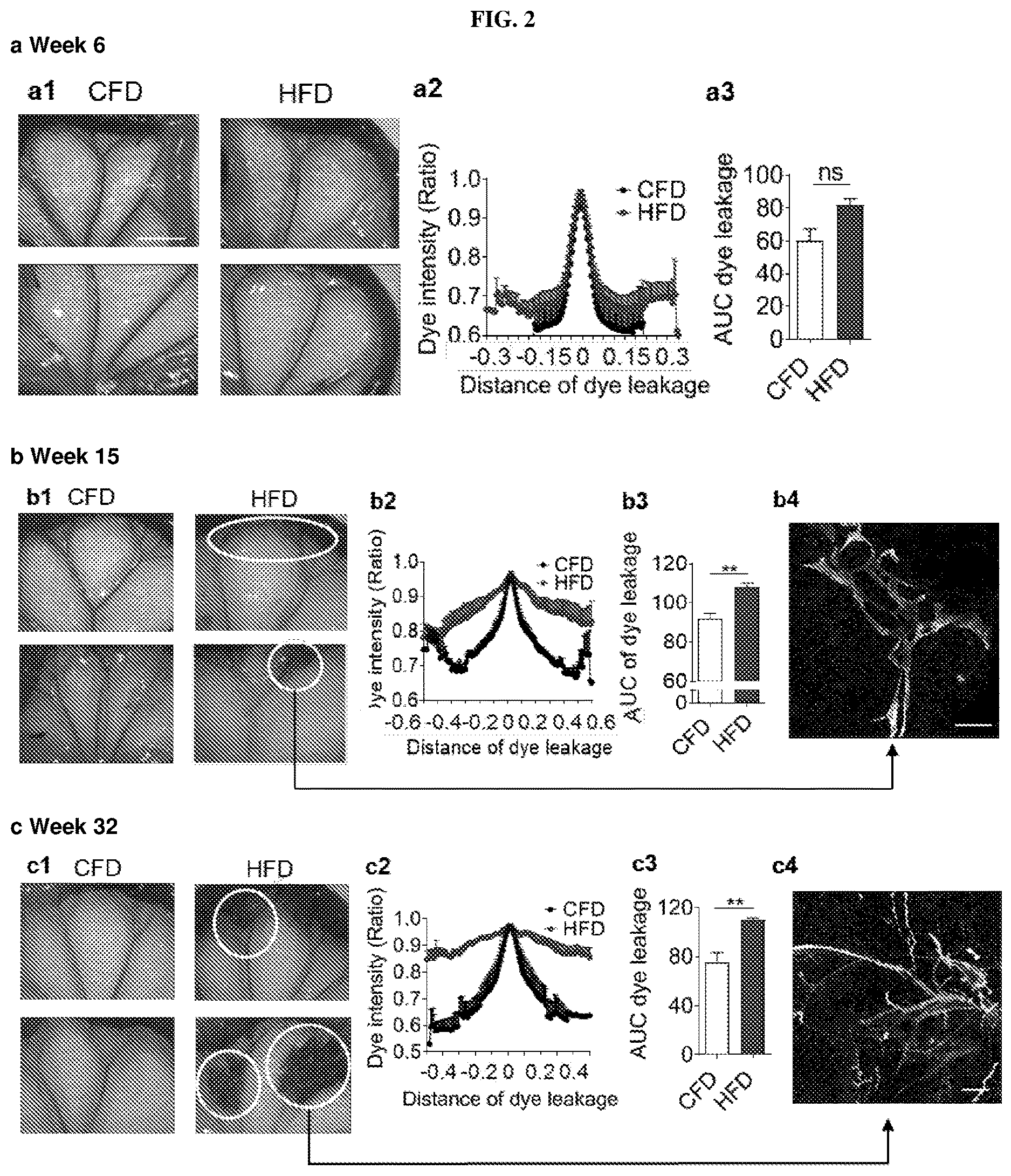 Patent US12611415 Figure 2 – Methods and compounds for treatment of metabolic disease